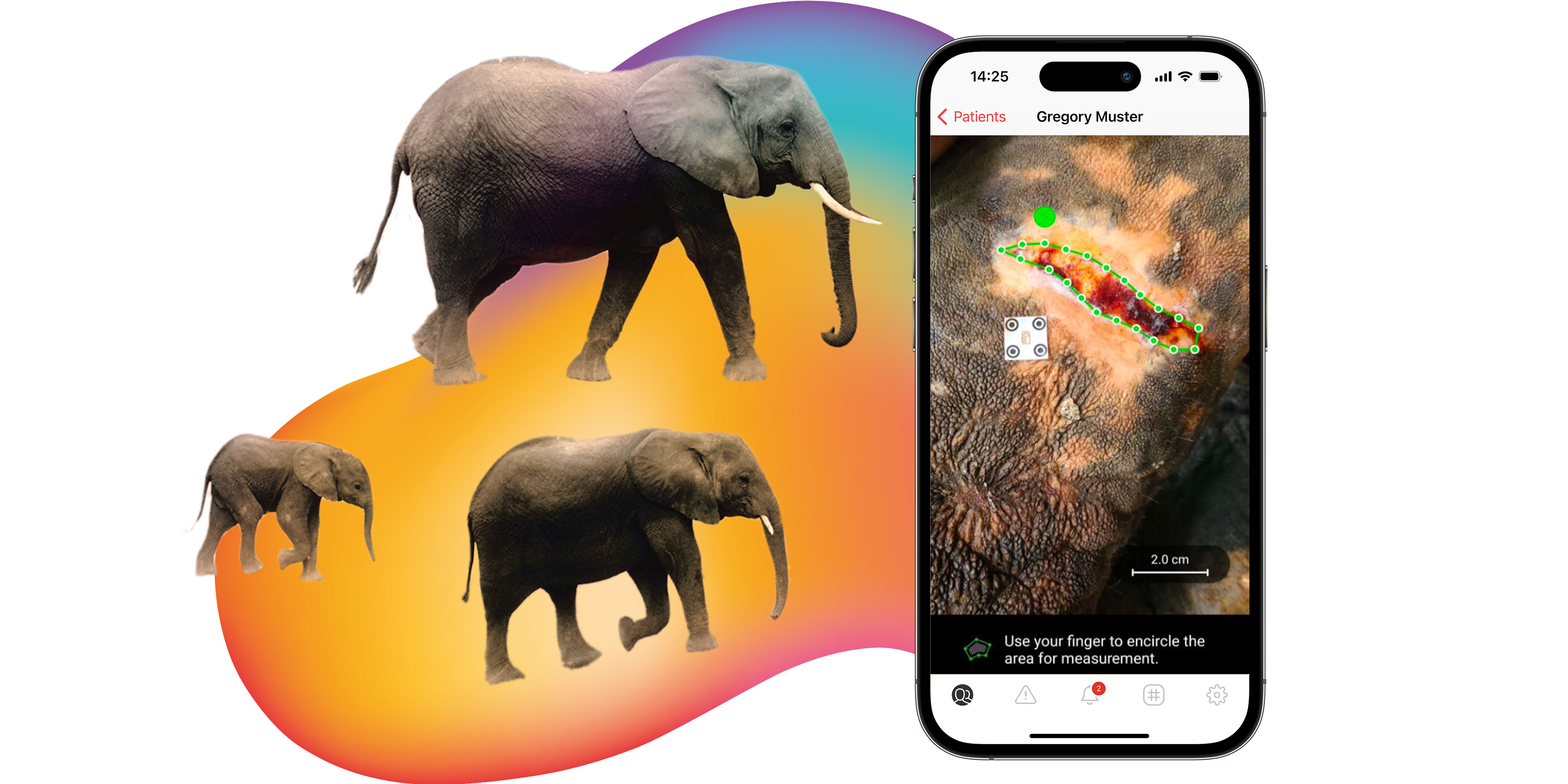 imito for clinical research - precise digital wound measurement