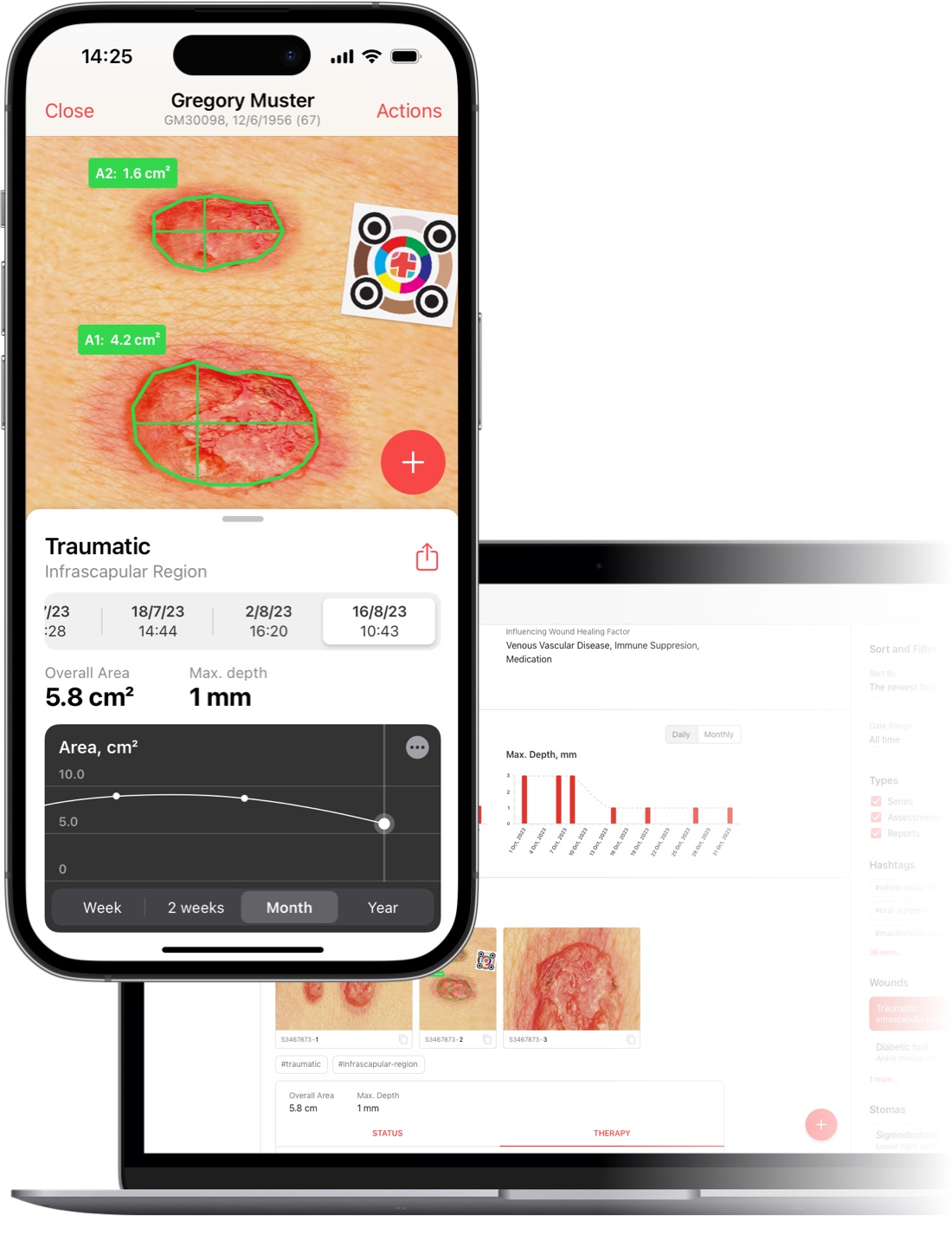 imitoWound - Track Wound Progression on Mobile Phone and Desktop