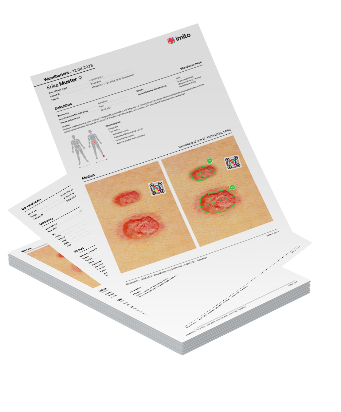 imito PDF Wundbericht