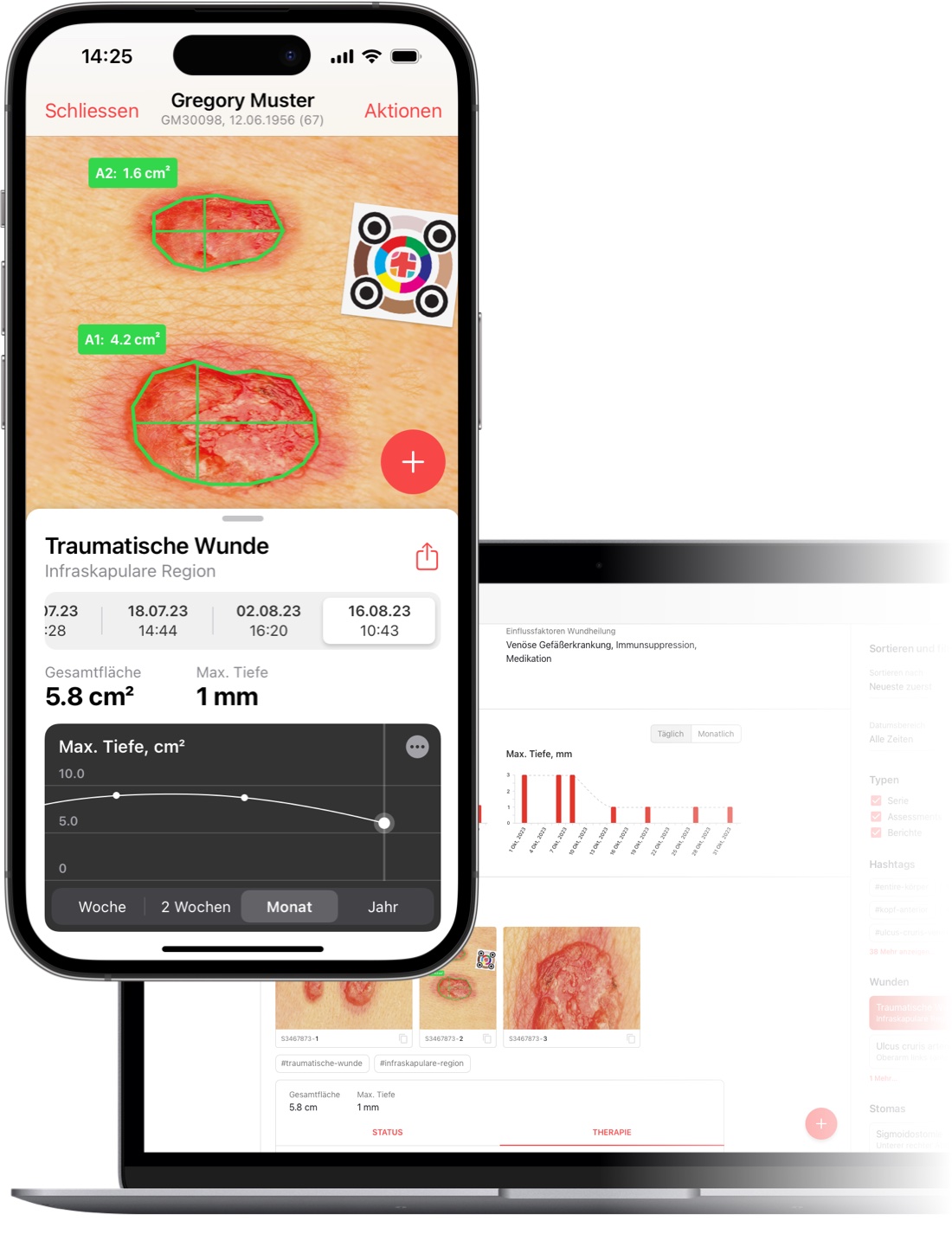 imitoWound - Verfolgen Sie die Wundheilung auf Handy und Desktop