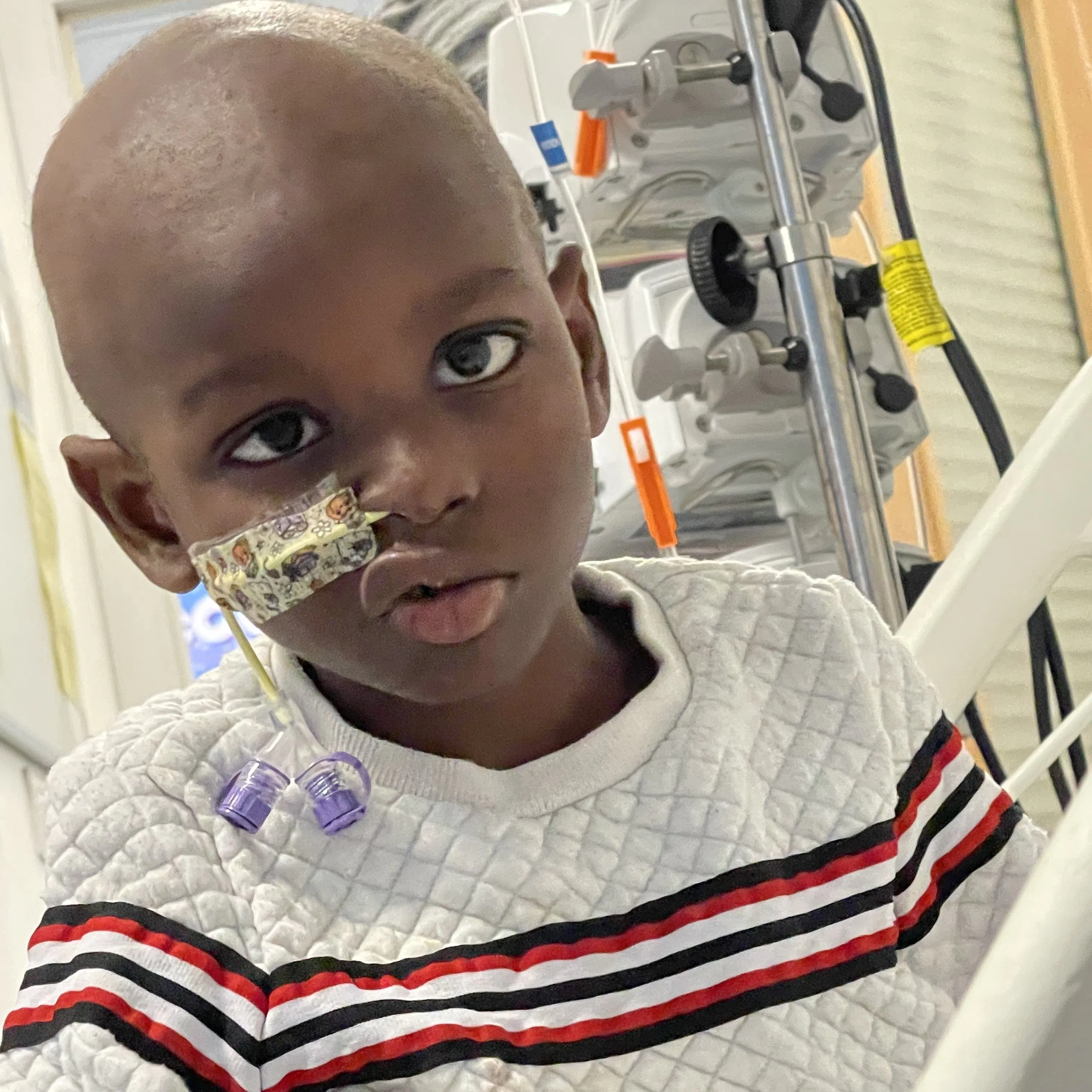Maxwell facing the camera with a feeding tube in nose. wearing a cream jumper with 3 red strips accross his chest