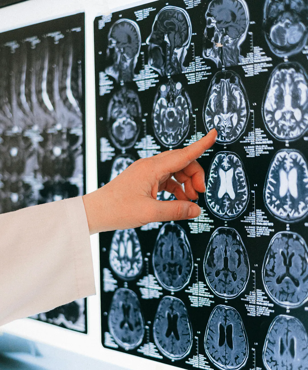 Understanding Trauma: A Journey Through the Brain and Beyond