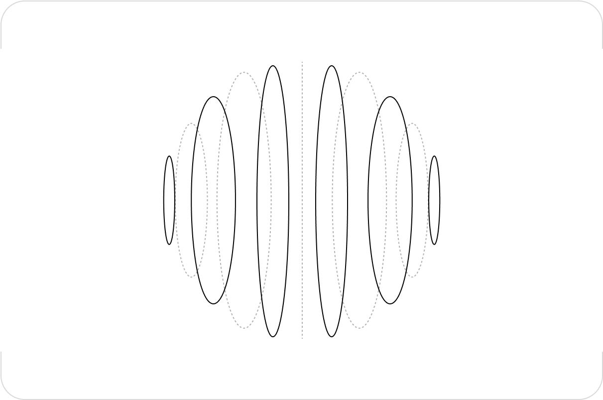 Audio Alignment