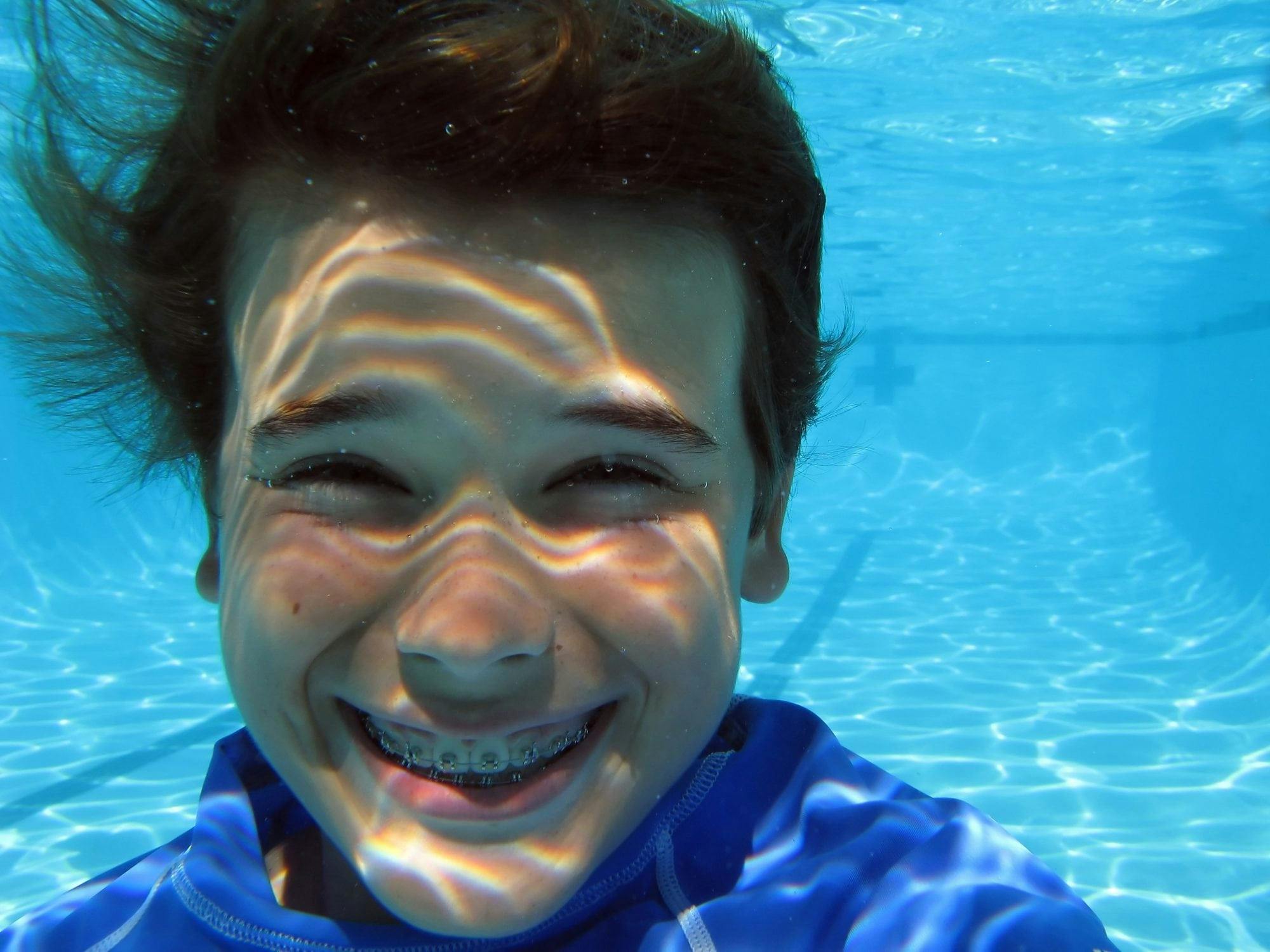 Photo of a young boy smiling with braces underwater