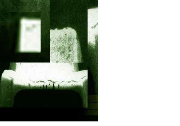 Palpitations Image 1