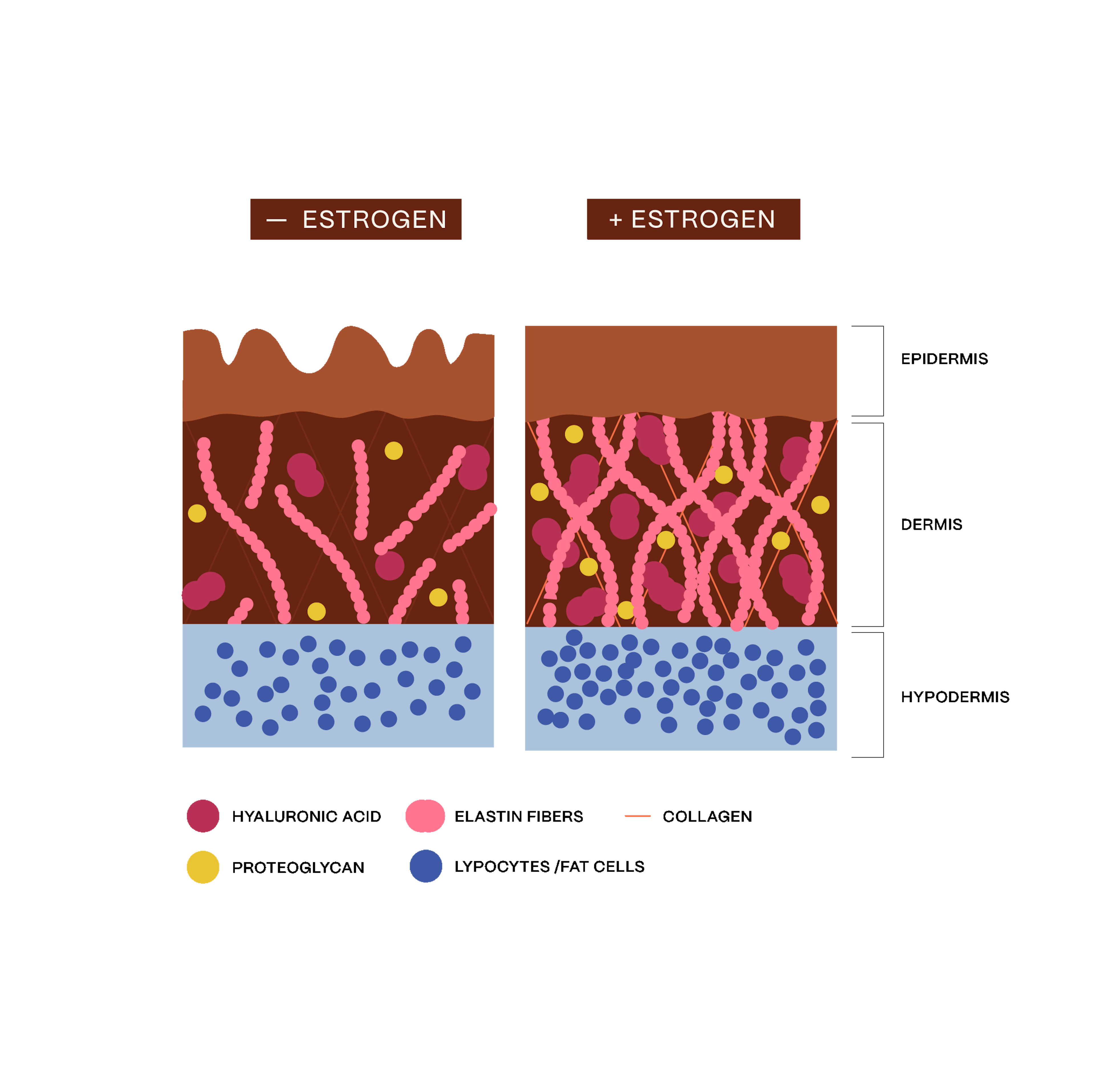 Diagrammatic illustration of the different impact of low and high estrogen epidermis, dermis and hypodermis skin layers