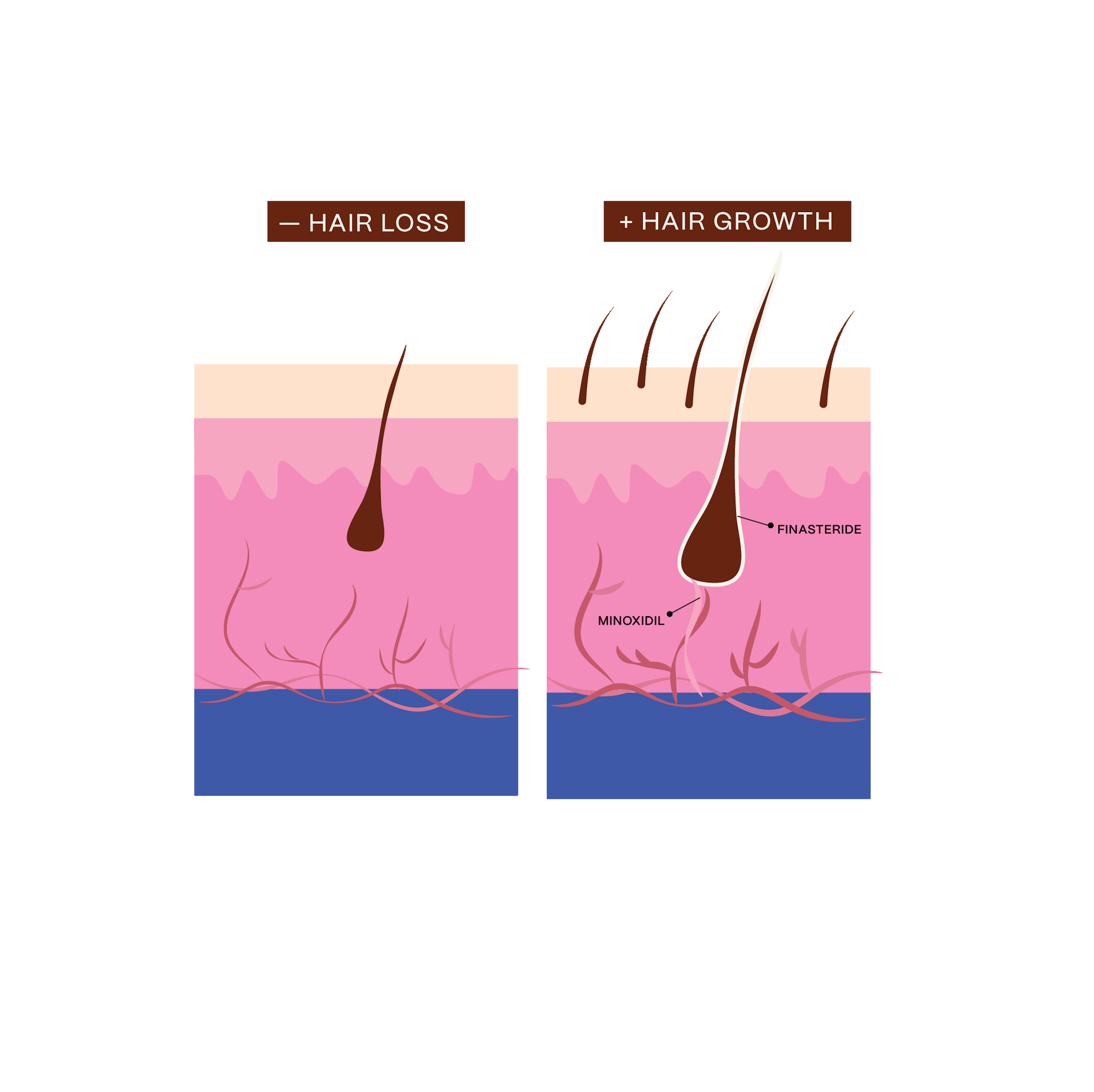 Diagrammatic illustration of hair growth before and after menopause