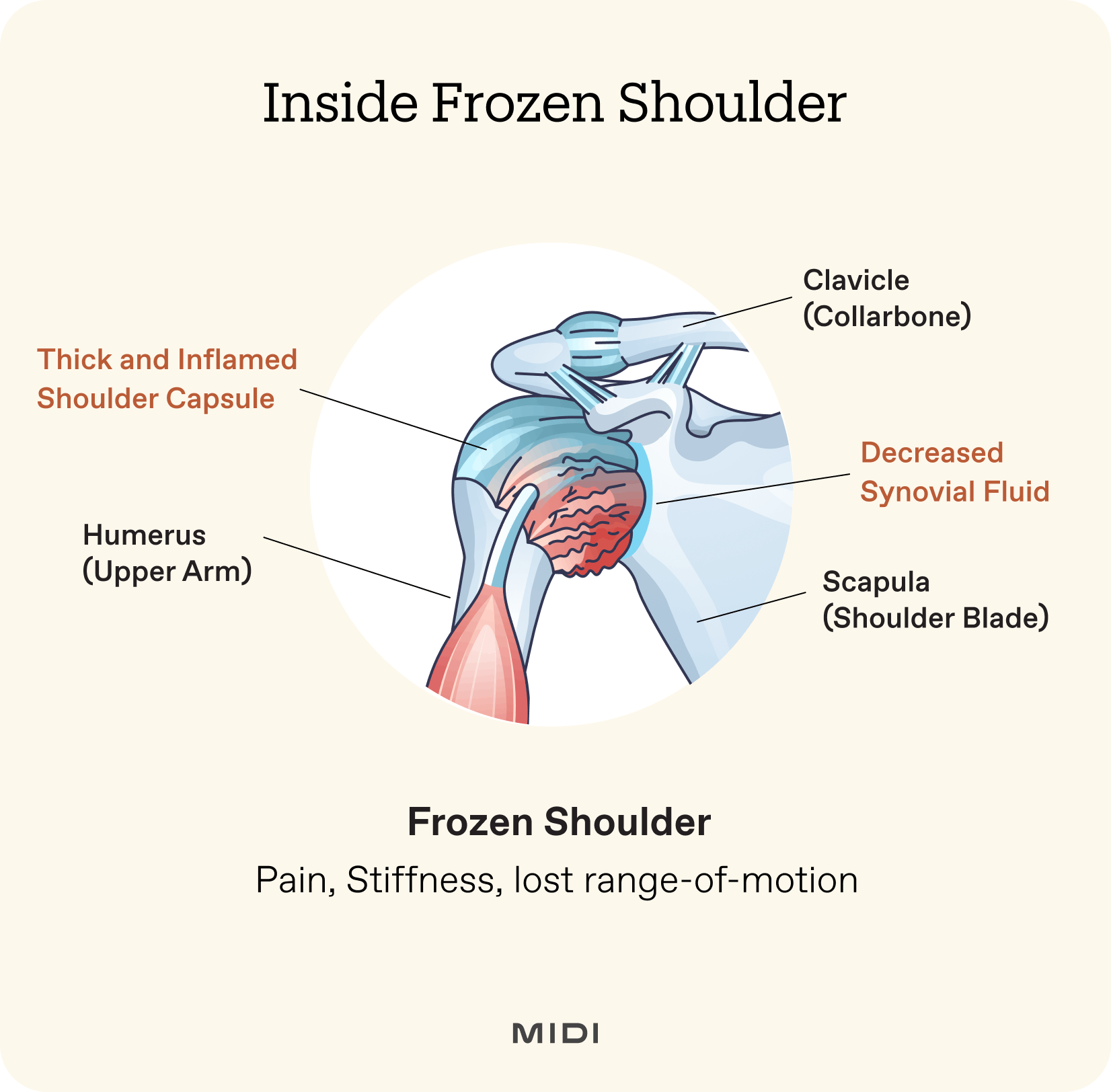 illustration of a shoulder joint with callouts