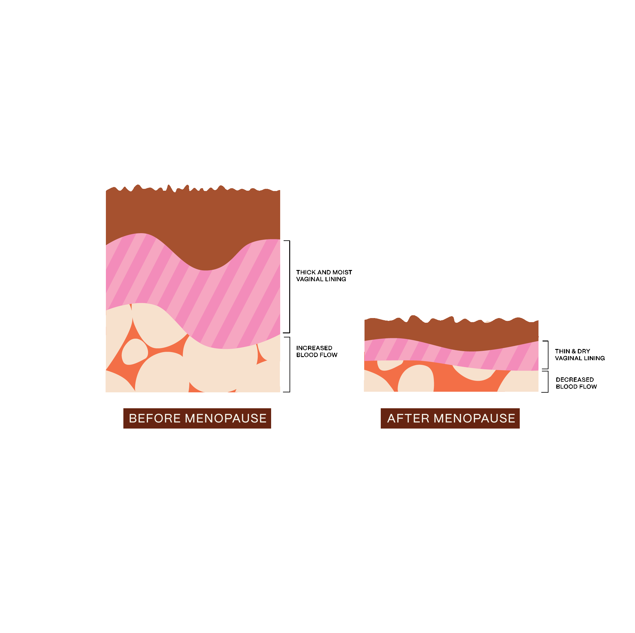 Infographic depicting the difference in vaginal lining and blood flow before menopause and after menopause