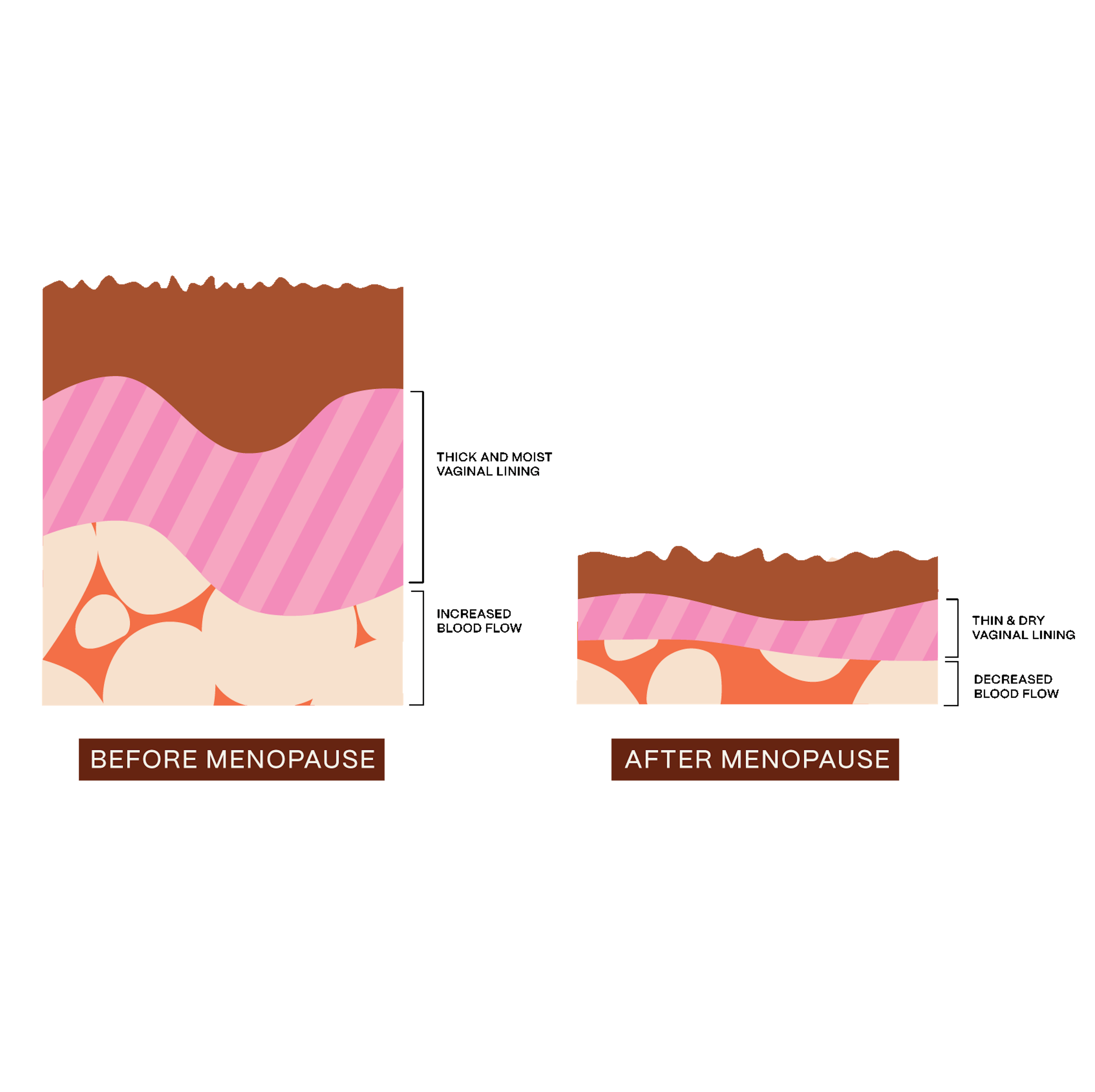 Infographic depicting the difference in vaginal lining and blood flow before menopause and after menopause