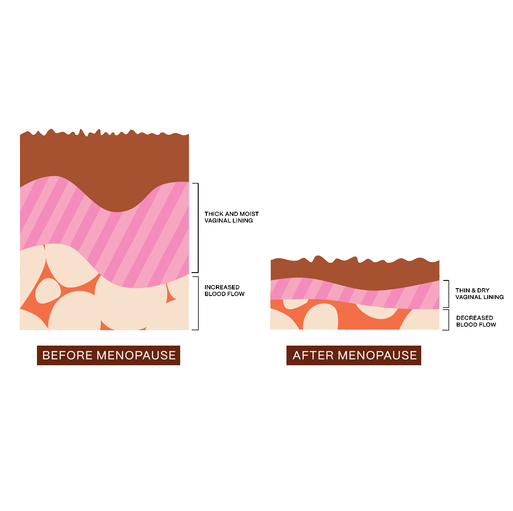 Infographic depicting the difference in vaginal lining and blood flow before menopause and after menopause