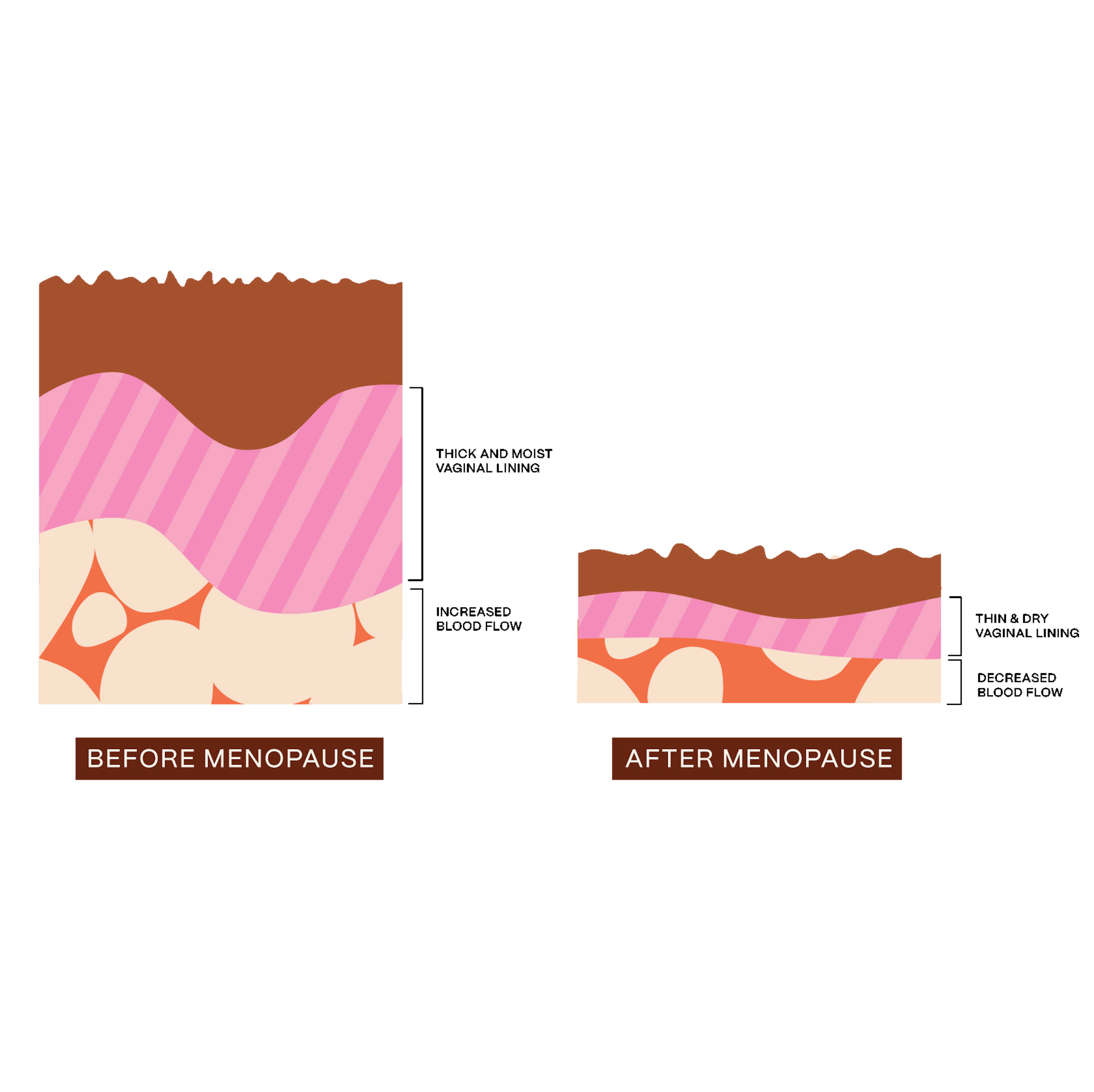 Infographic depicting the difference in vaginal lining and blood flow before menopause and after menopause
