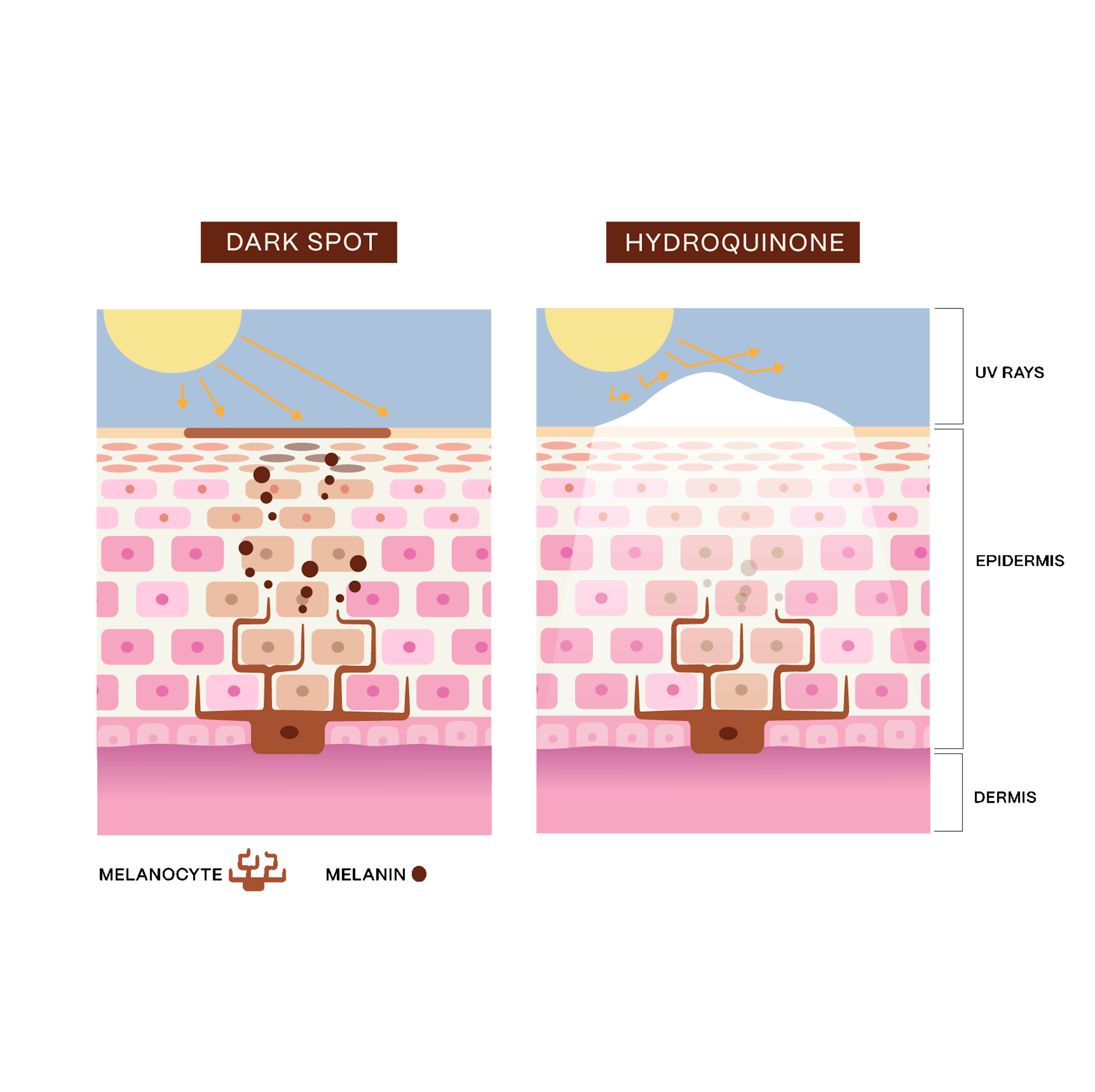 Diagram of melanin before and after aging