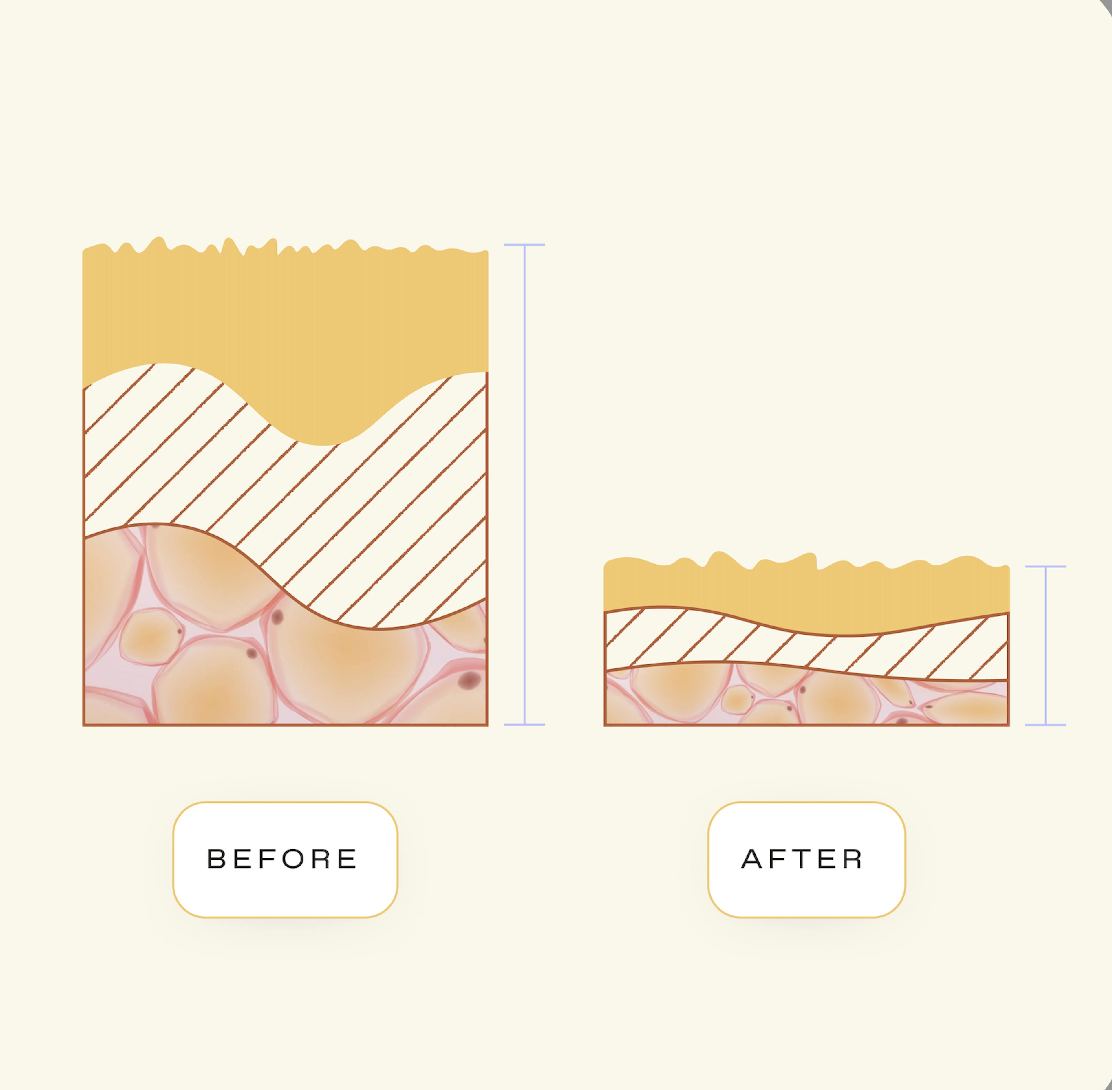 Before and After infographic of estrogen and its affects on the vagina and vulva.