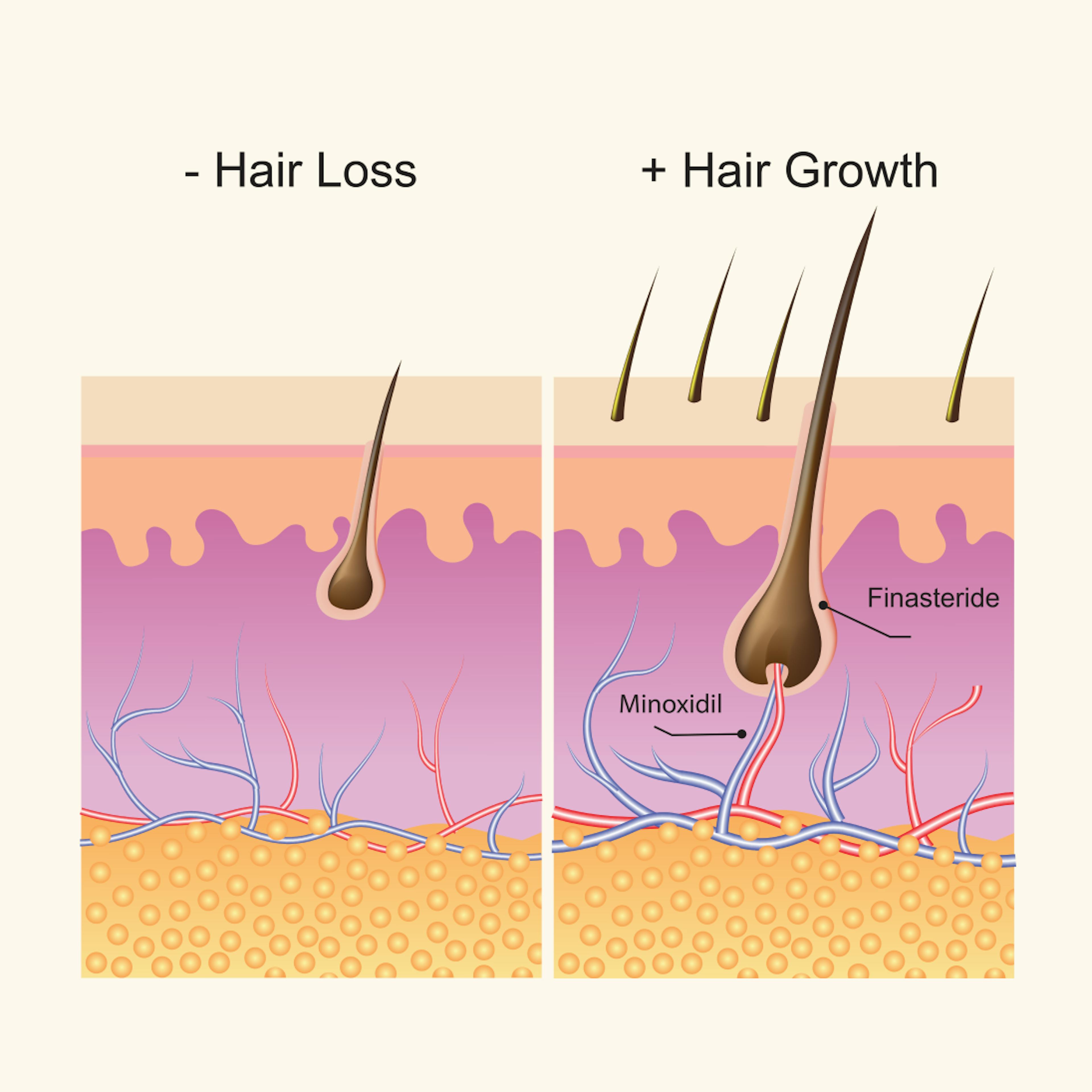 hair changes during menopause diagram