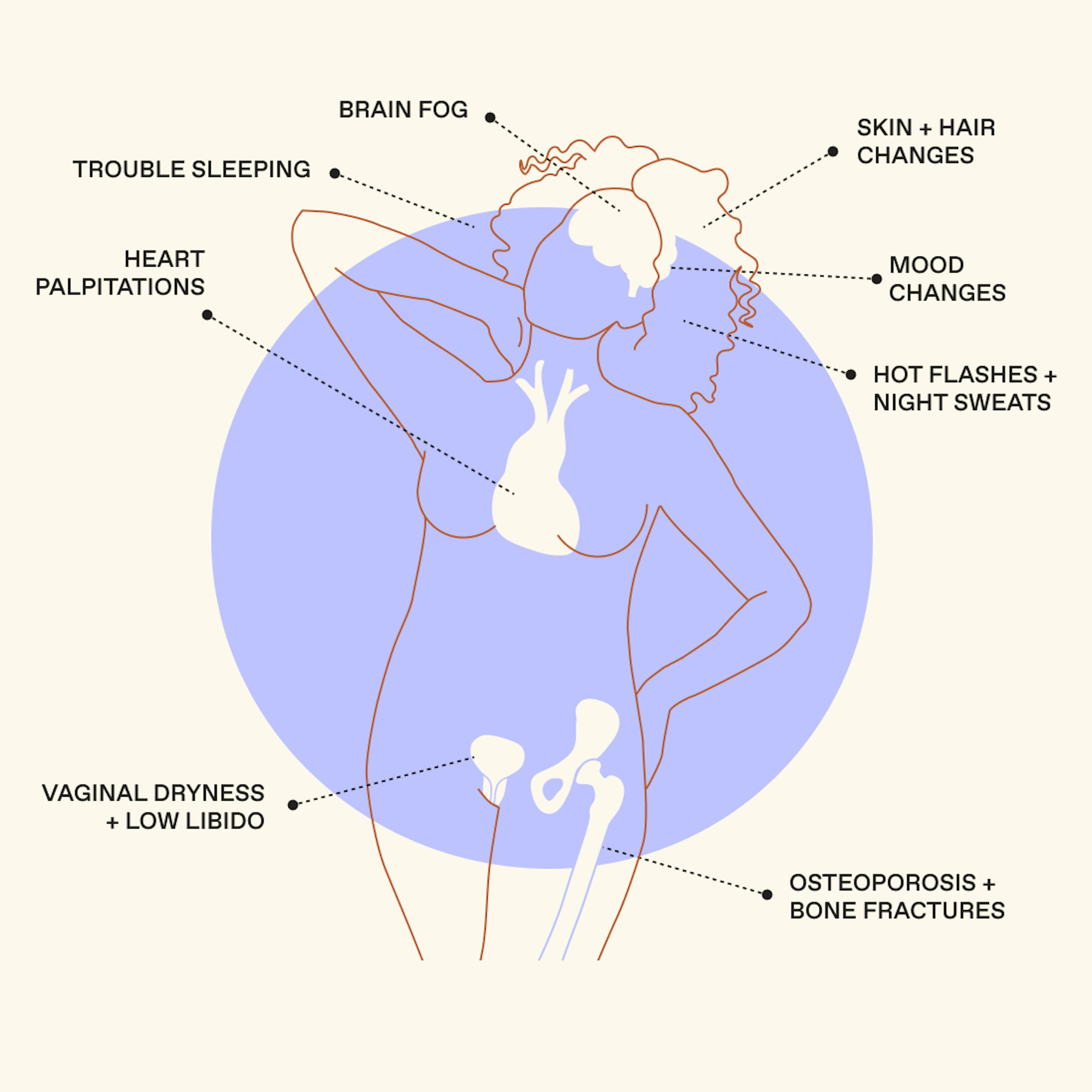 Diagram of menopause symptoms