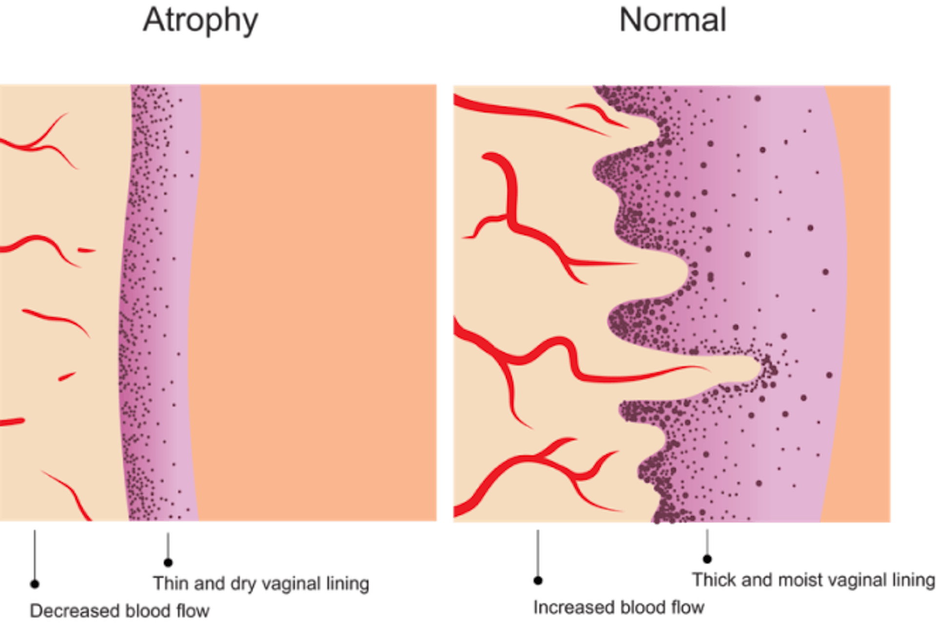 arousal