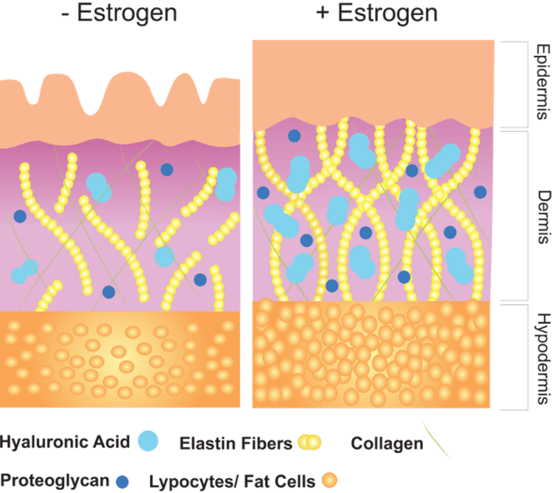 Diagram of skin before and after estrogen declines