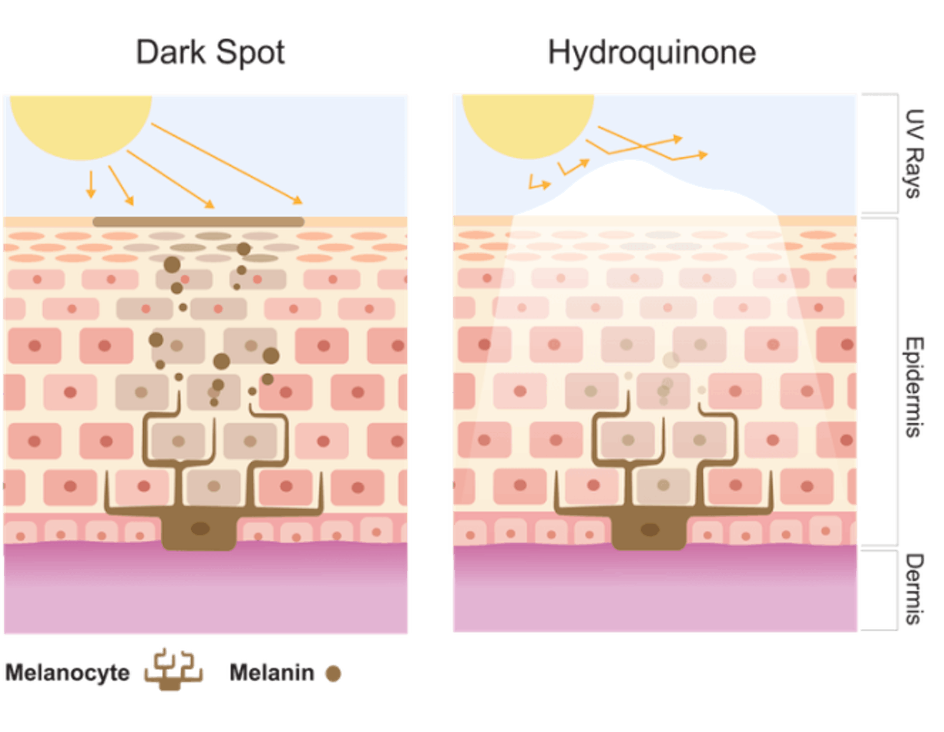 Diagram of melanin before and after aging