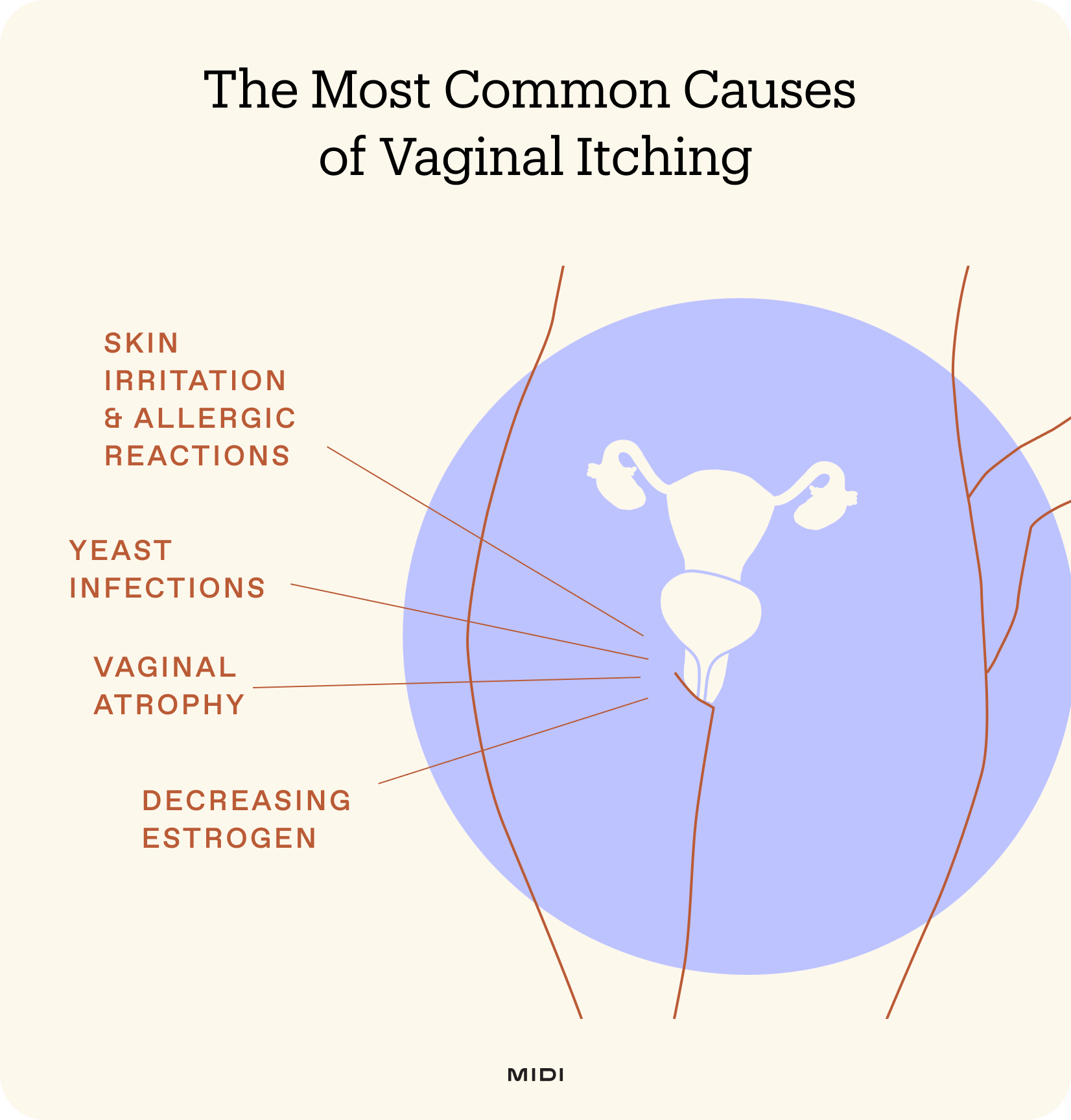 outline of a female anatomy with callouts to common causes of itching