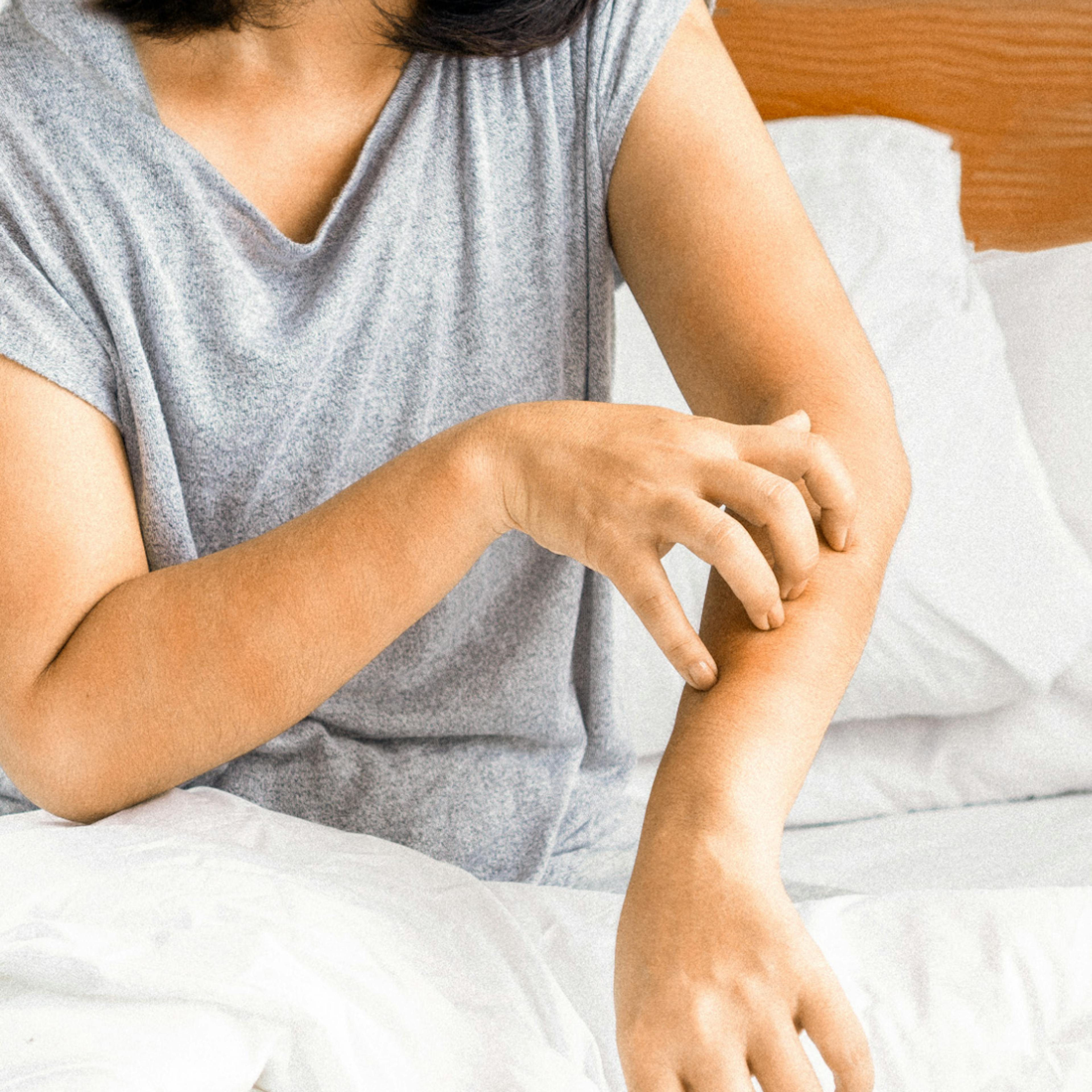 image of a woman scratching her arm
