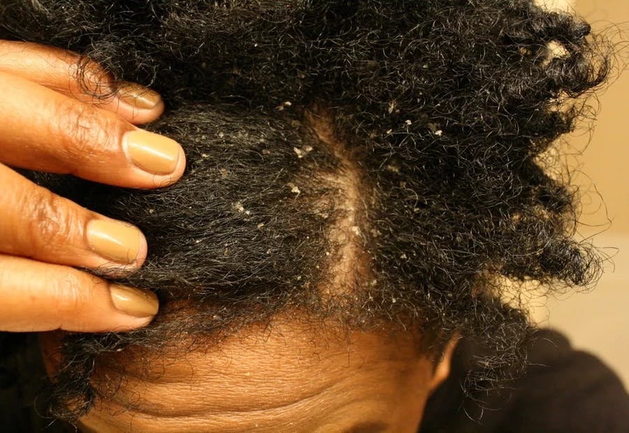 black dry hair treatment