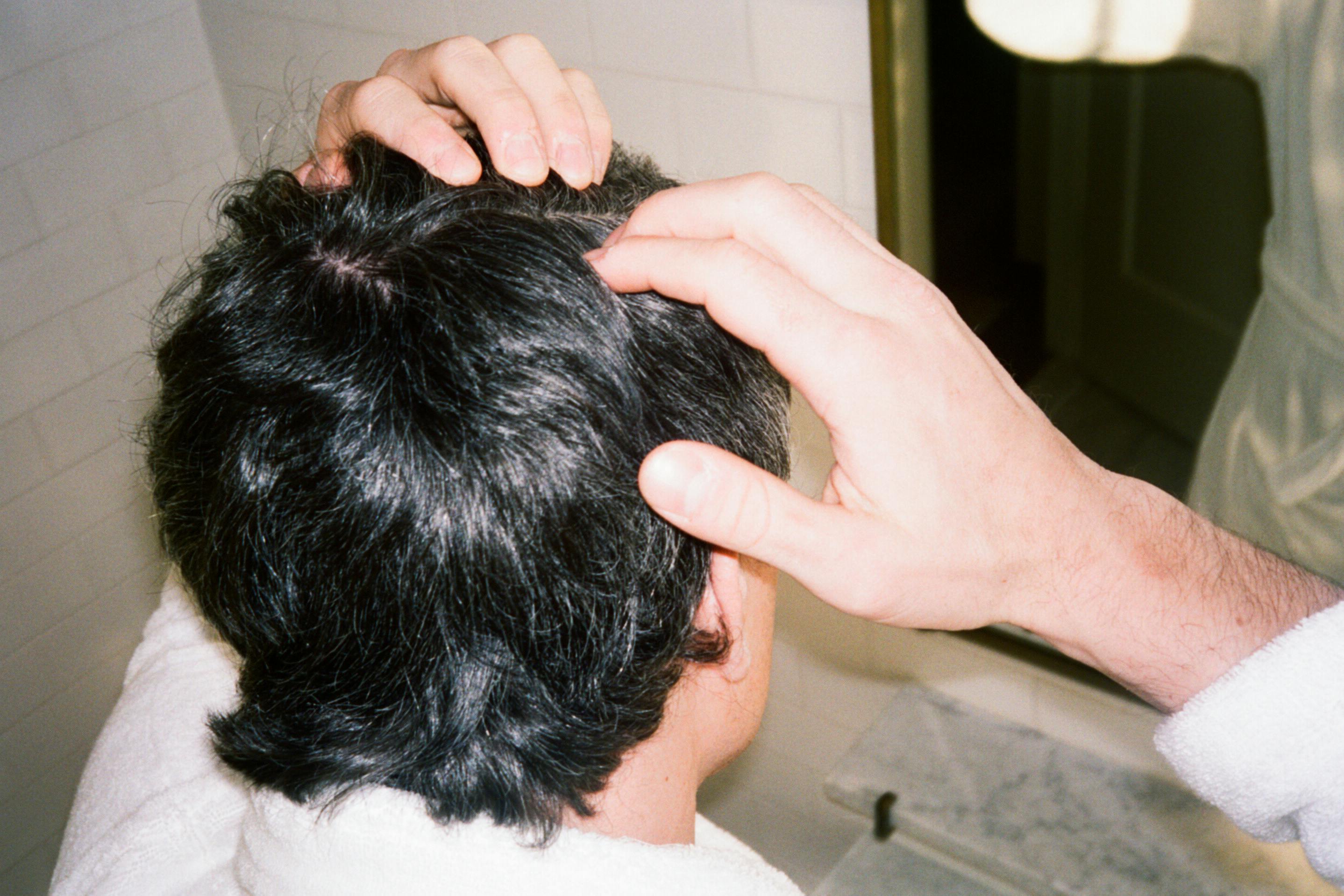 Best shampoo for itchy scalp