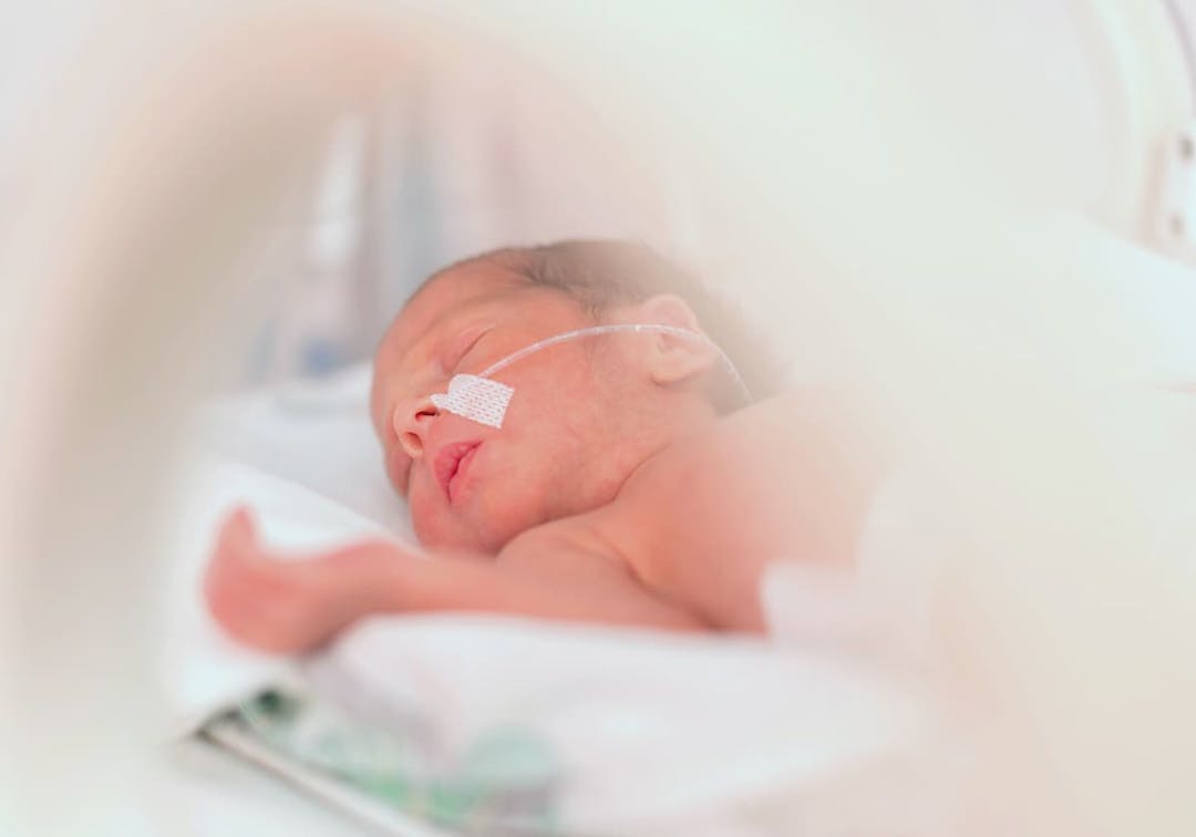 prematurfödd bebis