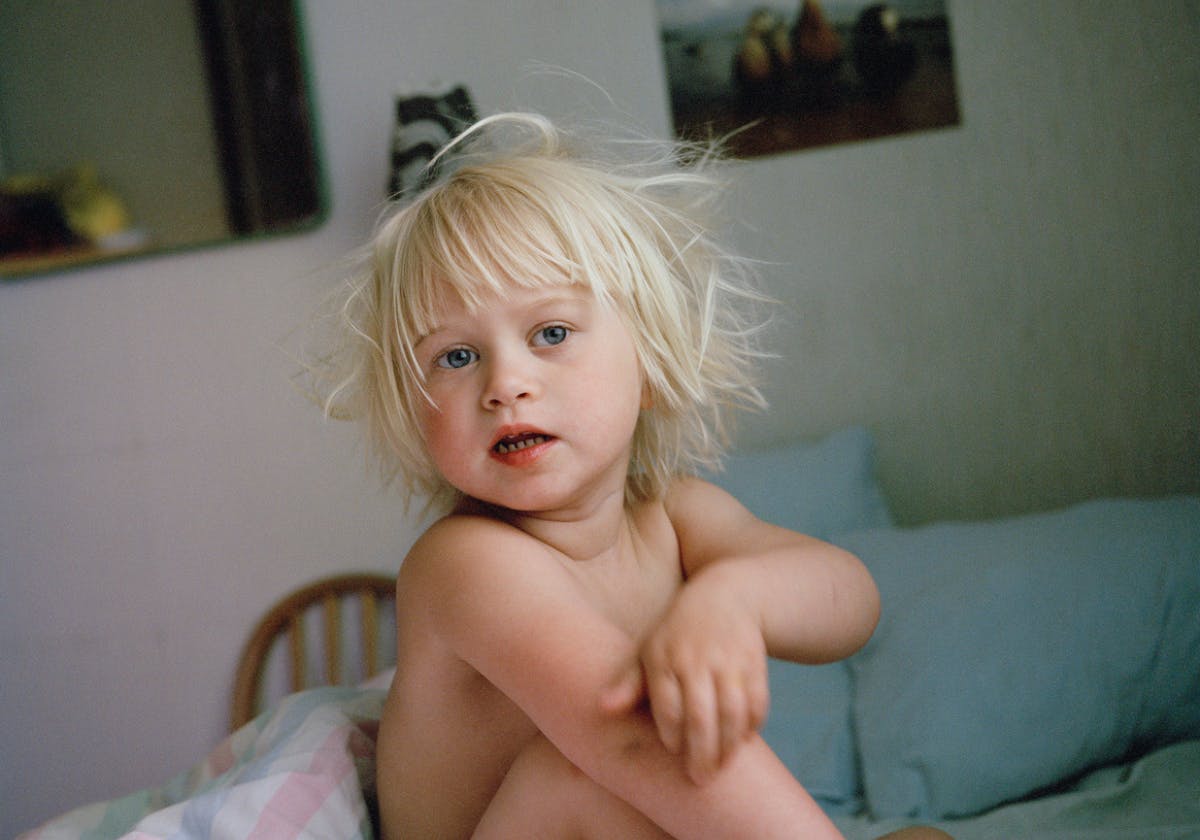 Litet barn som kliar på sin arm.