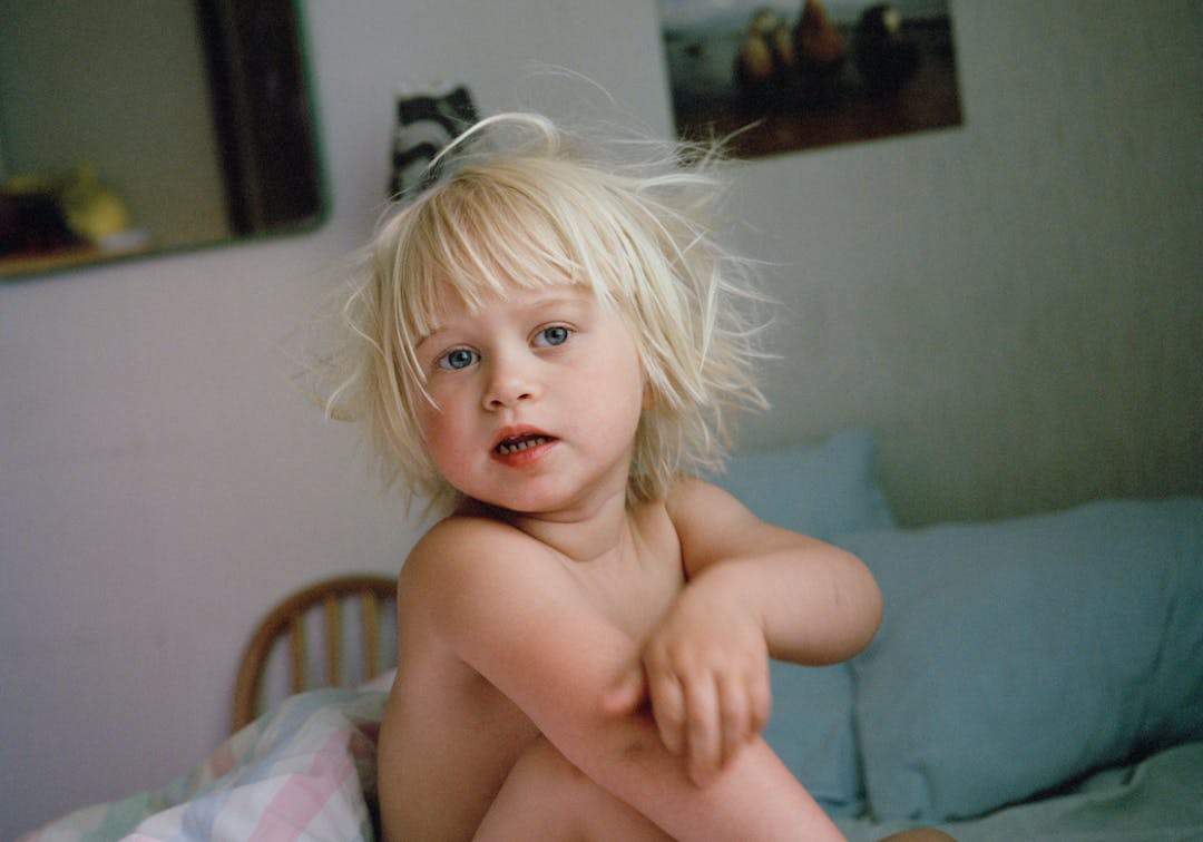 Litet barn som kliar på sin arm.