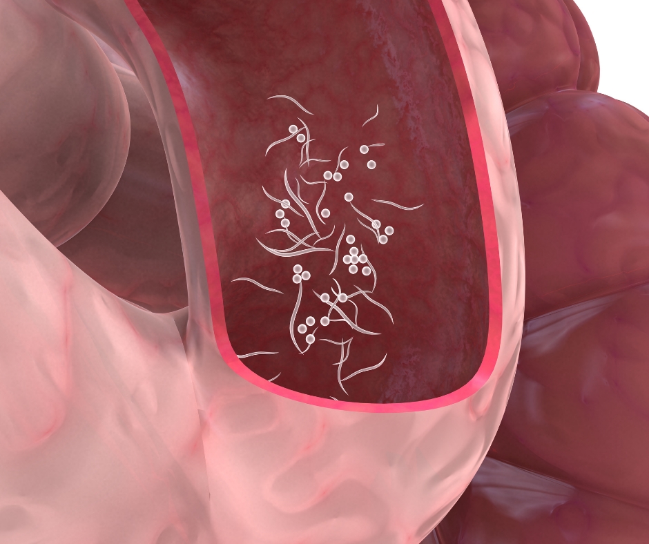Springmask (mask i magen) hos barn | Fakta & råd | Knodd