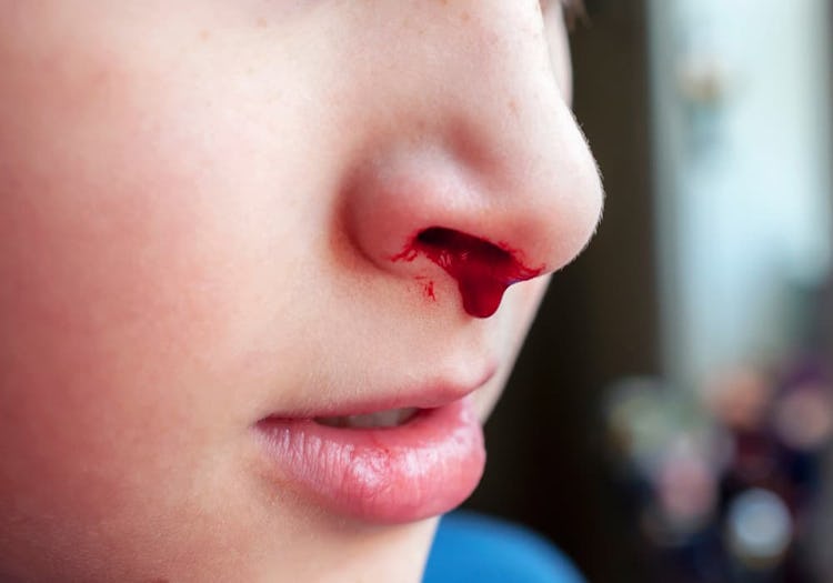 barn som blöder näsblod