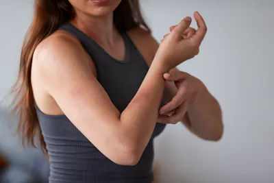 Women itching skin due to dryness picture