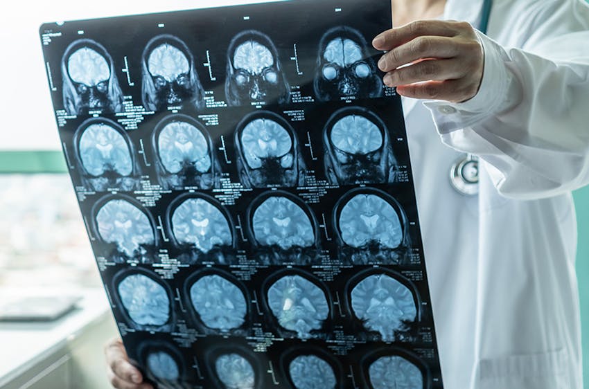 Decorative: Sports medicine doctor reviewing brain scans