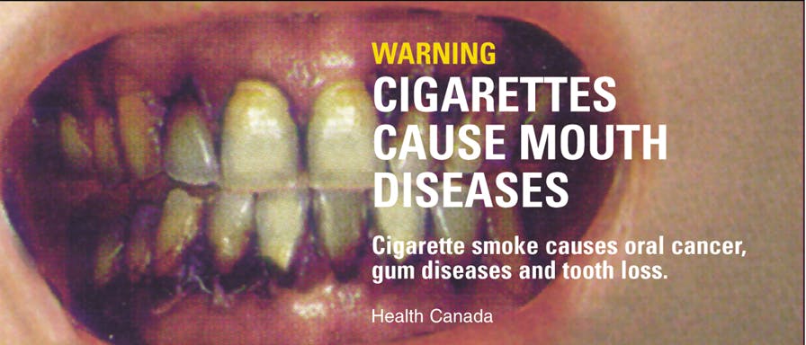 Cigarette warning