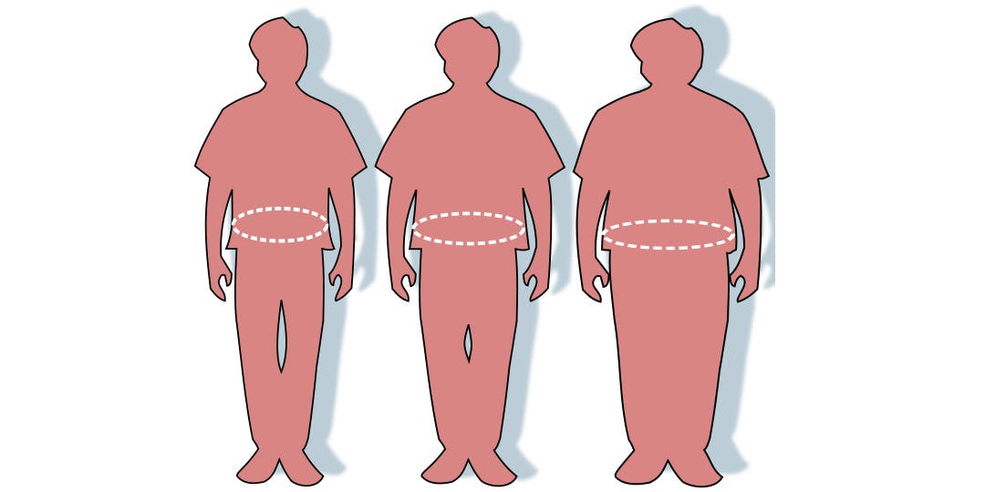 Trois silhouettes décrivant l'écart entre la silhouette en bonne santé (à gauche), le surpoids (au milieu) et l'obésité (à droite).