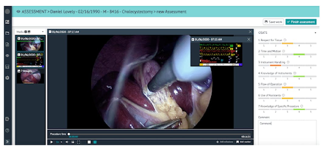 Image from a scoping procedure