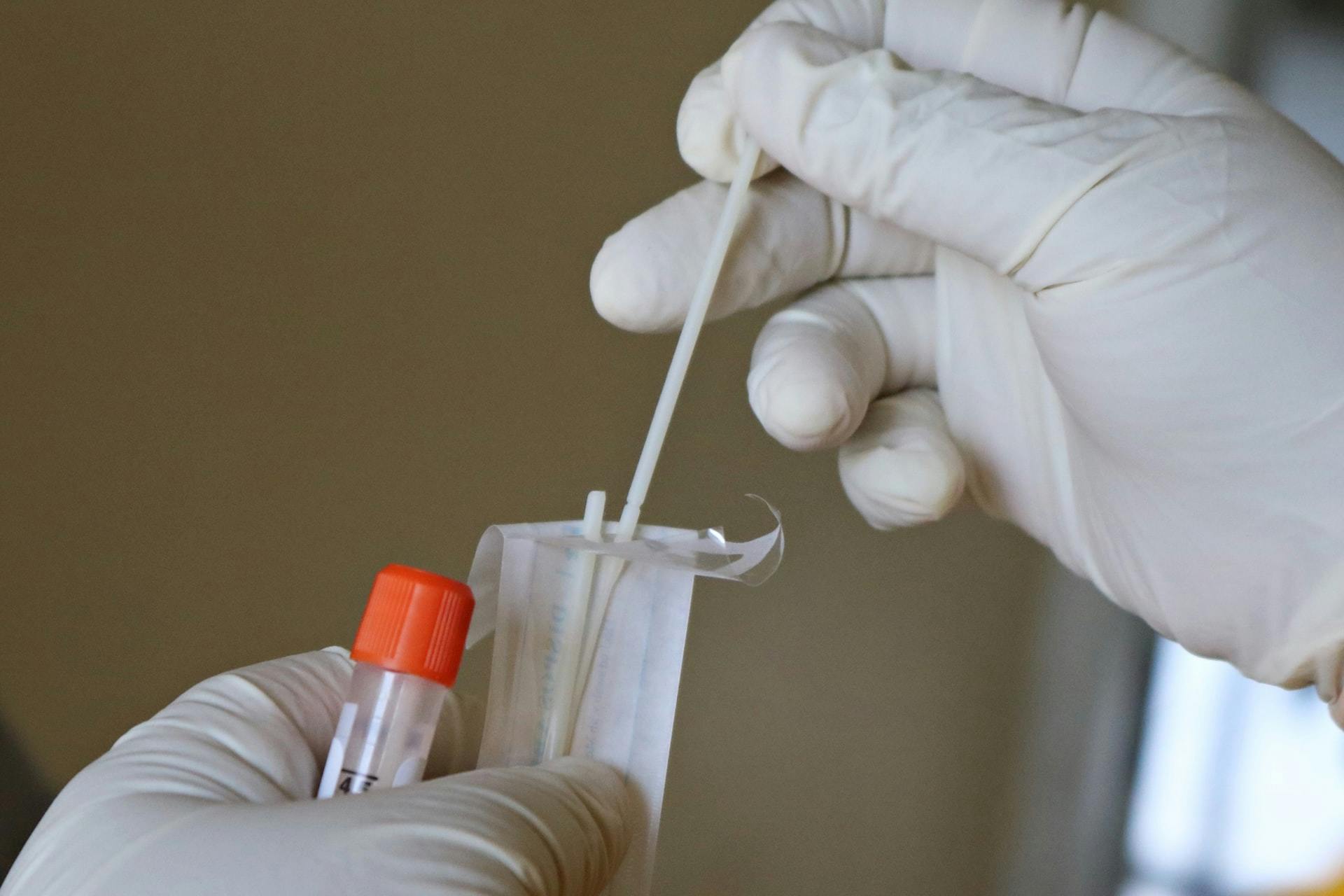 Test PCR en entreprise