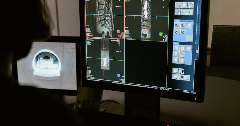 Person looks at two monitors one showing results of a CT scan and the other showing a video feed of the machine