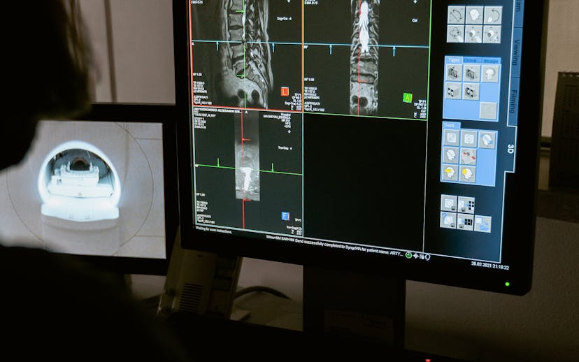 Person looks at two monitors one showing results of a CT scan and the other showing a video feed of the machine