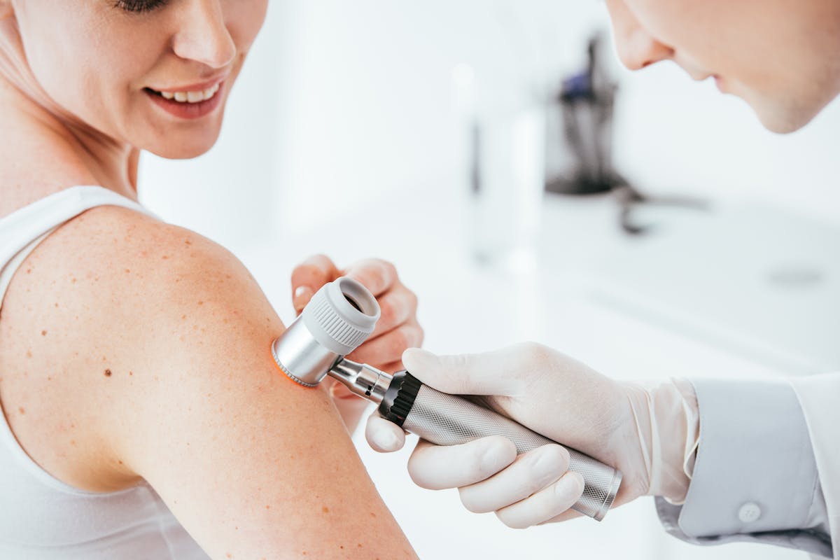Can Melanoma Be Prevented? Life Protect 24/7