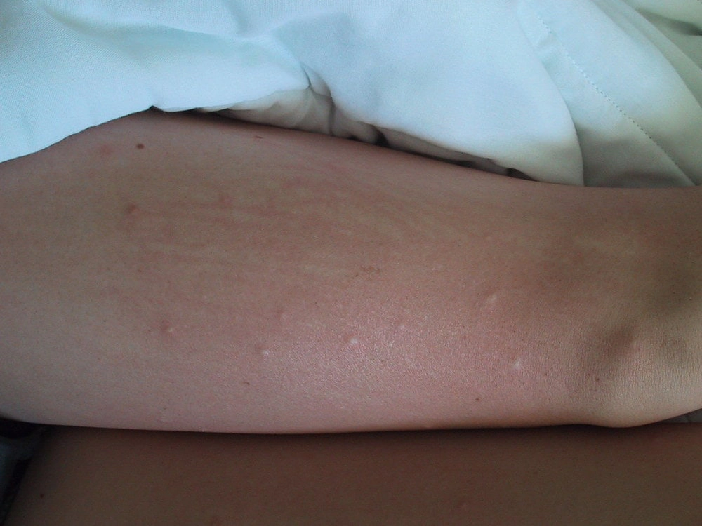 Puces De Parquet Comment S En Debarrasser Puces De Parquet Comment S En Debarrasser