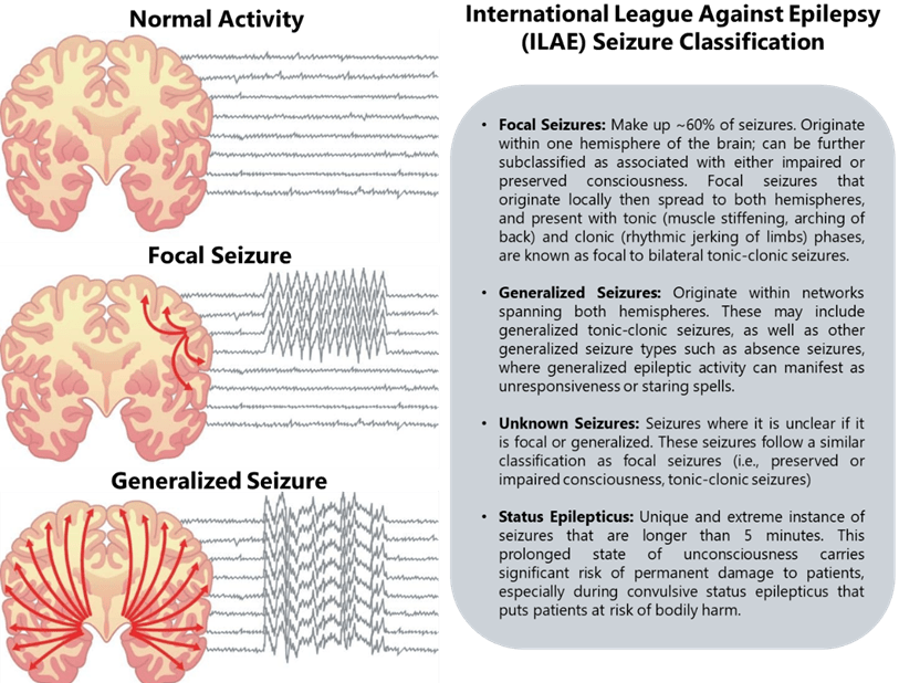 ILAE seizure classification