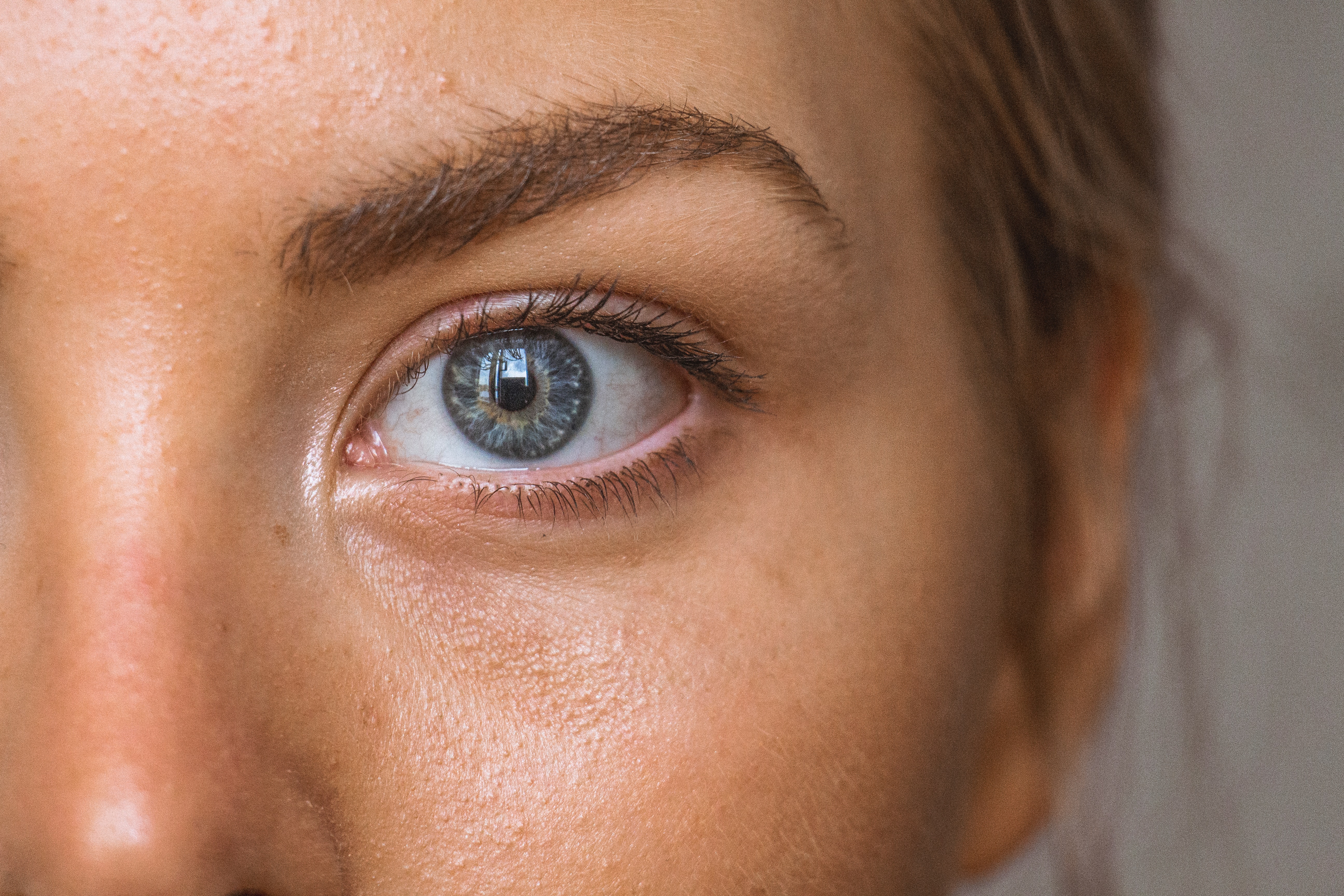Gros plan sur le contour de l’œil et les fines lignes sous les yeux
