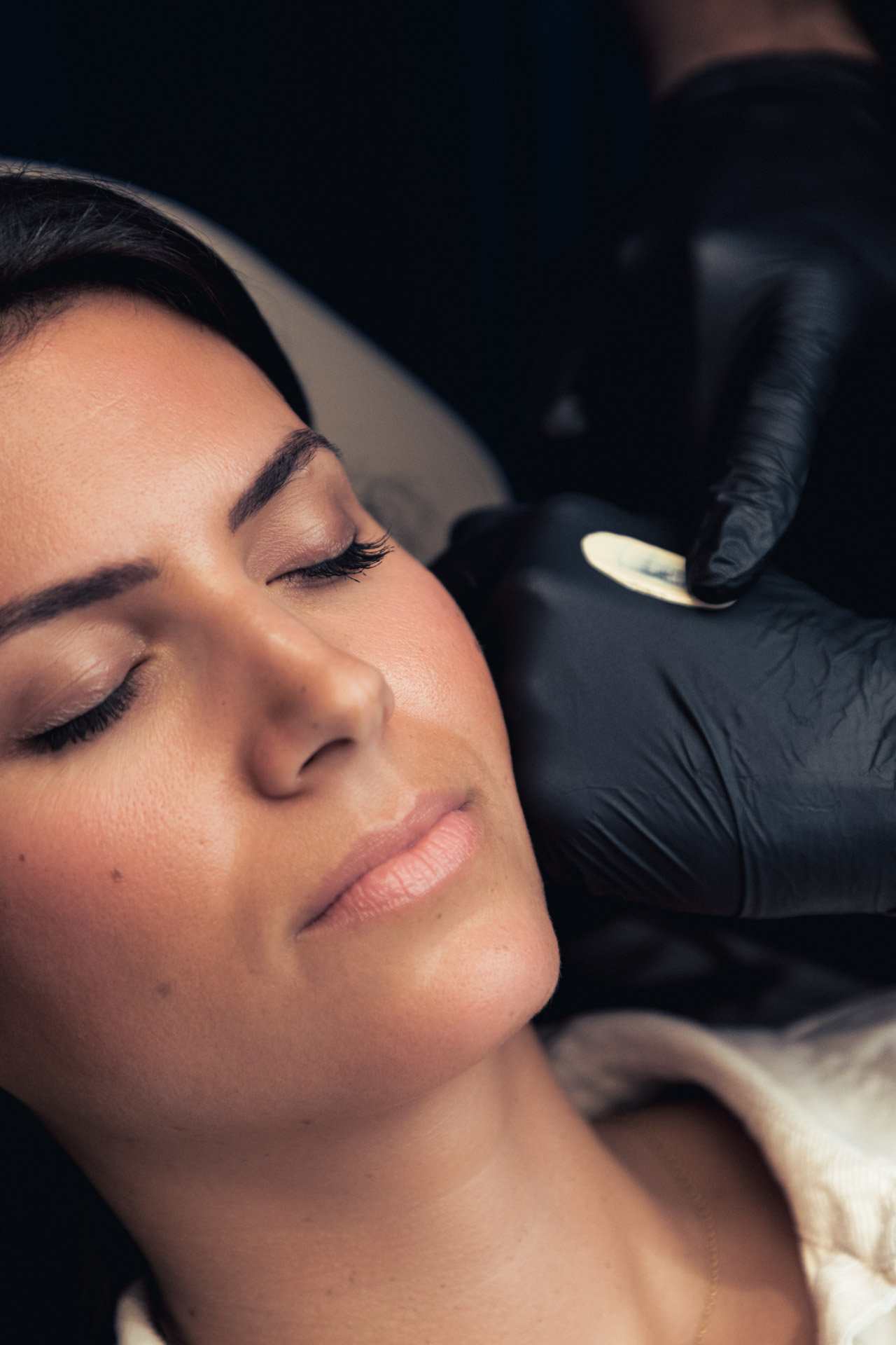 Protocoles et traitements de pointe pour lutter contre la couperose, rosacée et rougeurs du visage à Lyon chez Maison Yoko