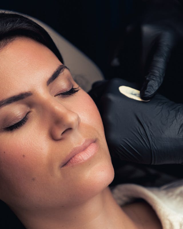 Protocoles et traitements de pointe pour lutter contre la couperose, rosacée et rougeurs du visage à Lyon chez Maison Yoko