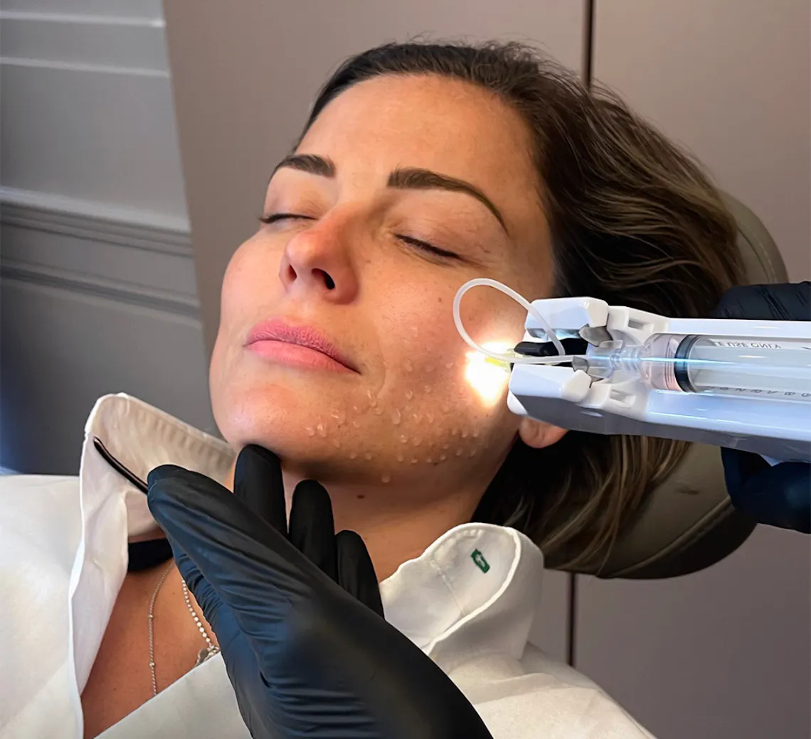 Traitements de l'automne selon le type de peau