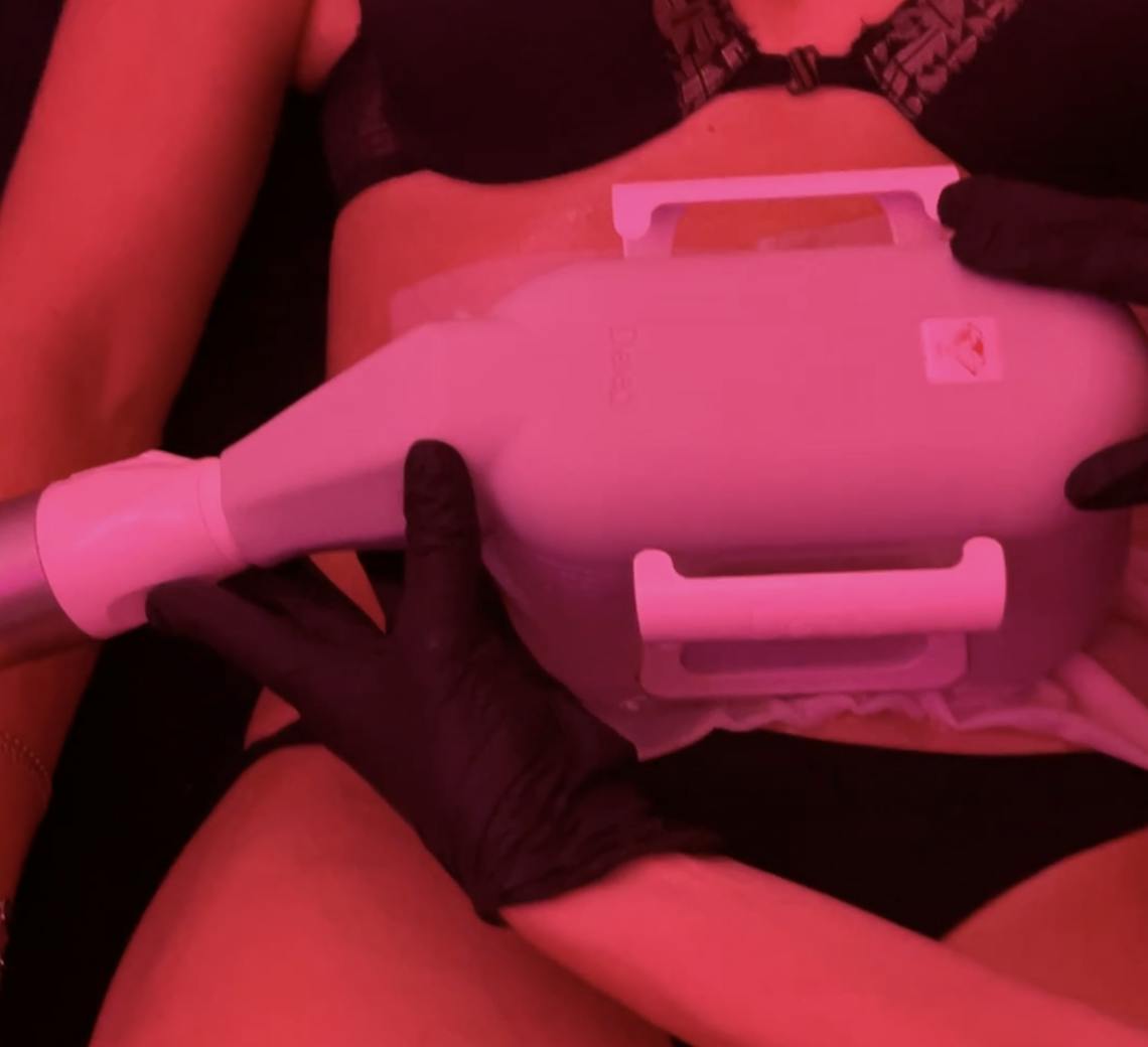 Investissez en vous sur le long terme : la cryolipolyse est un moyen, pas une fin en soi