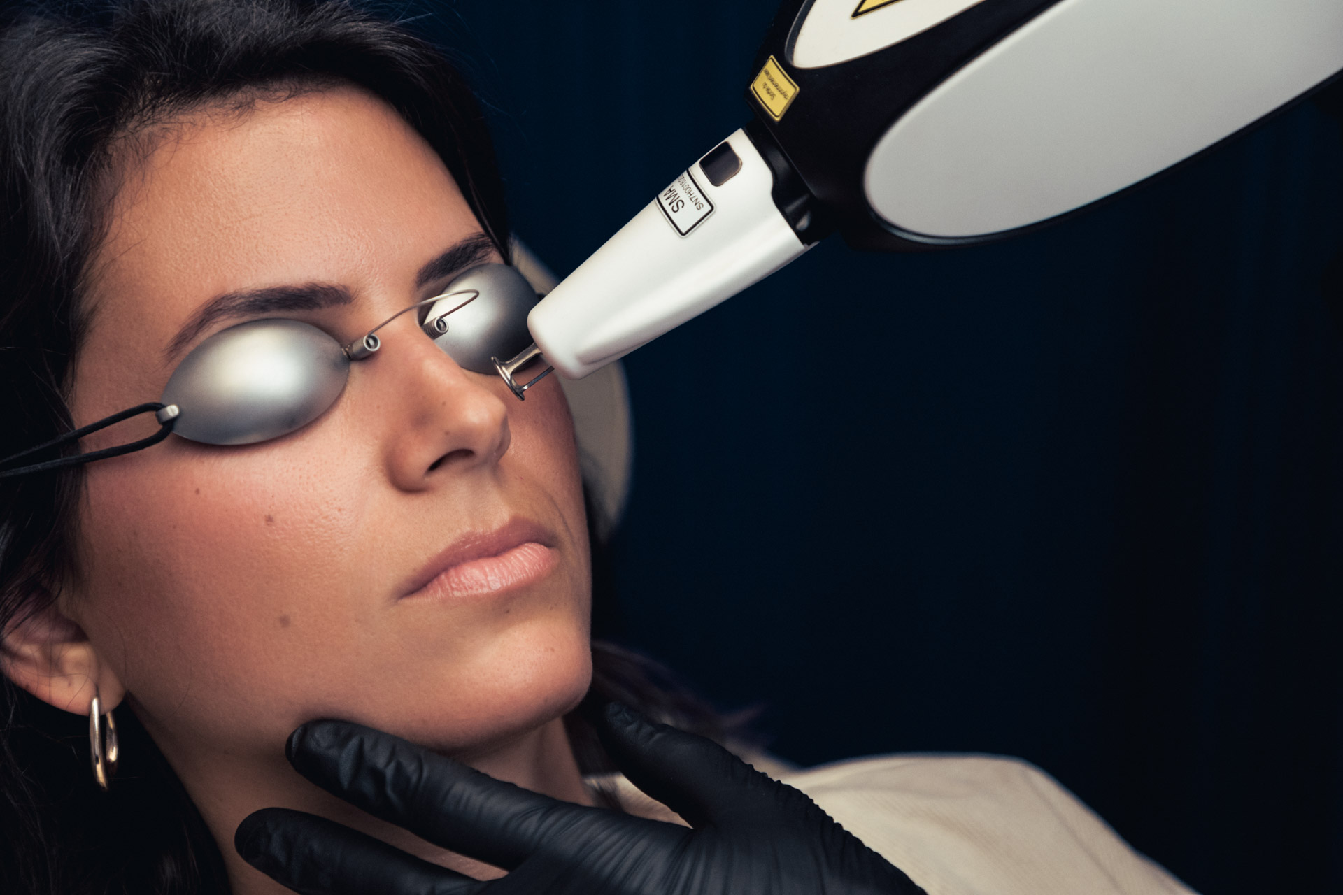 Éliminer les lésions vasculaires inesthétiques des jambes et du visage : varicosités, couperose ou angiome grâce au laser vasculaire à Lyon