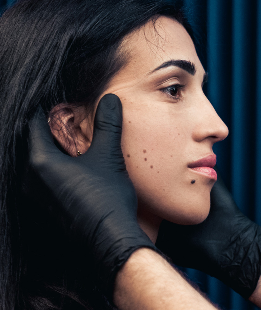 Retrouver une peau uniforme et lisse en traitant les lésions cutanées bénignes chez Maison Yoko à Lyon